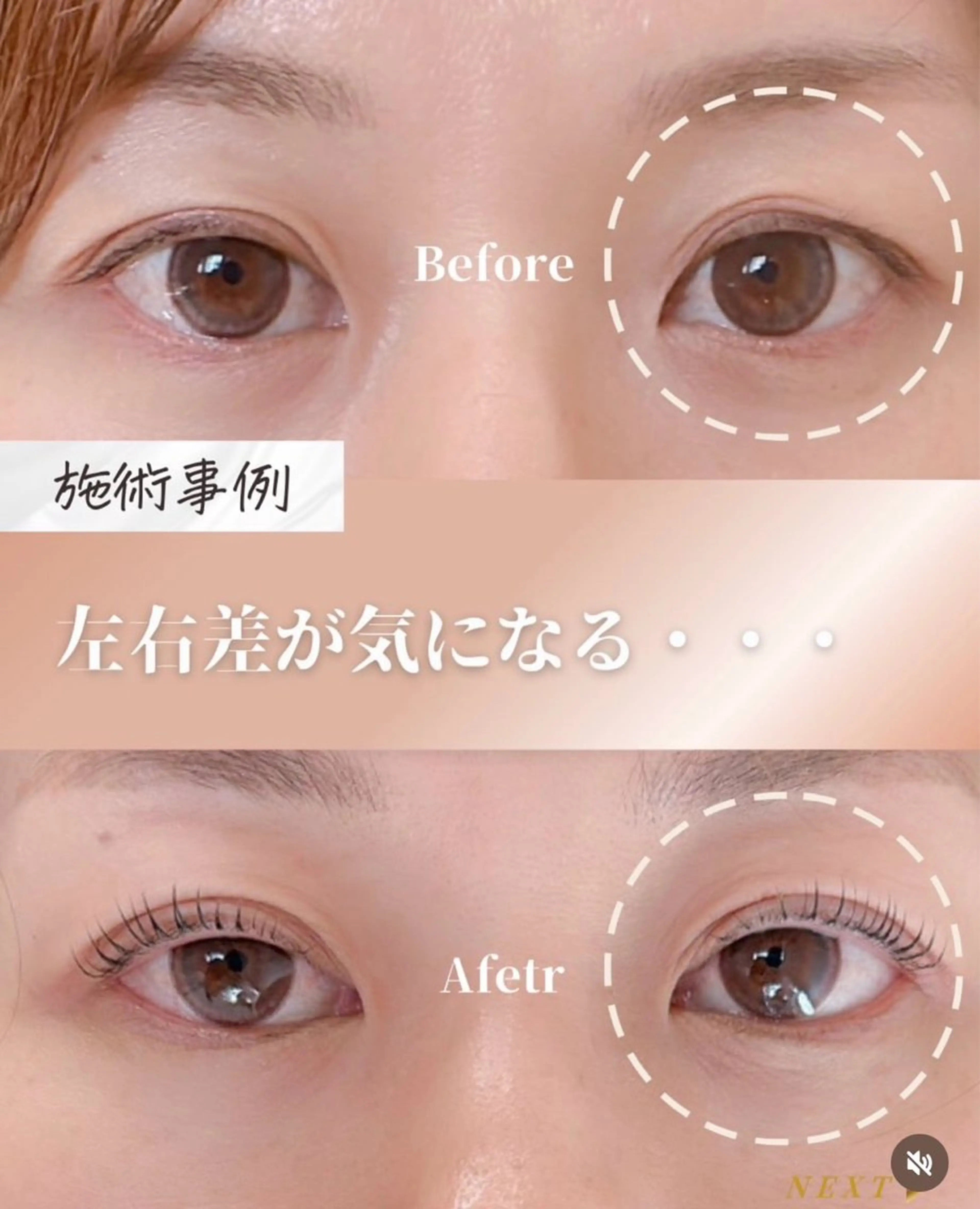 マツエク・マツパ マツパ 似合わせまつパ︎︎ 👀 ︎ /Otoeのマツエク・マツパデザイン