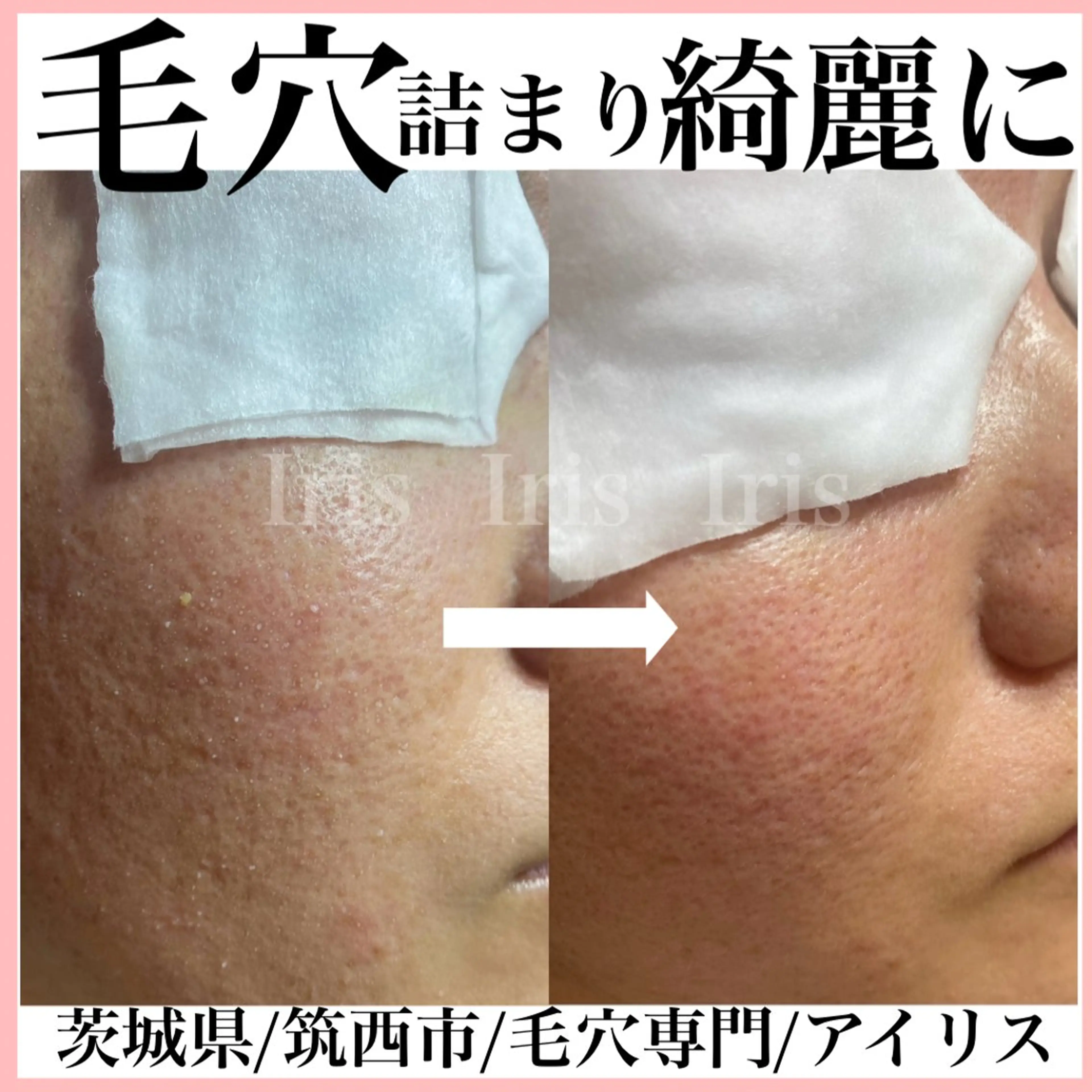 エステ Aki 似合わせまつ毛💎のエステ・リラクイメージ