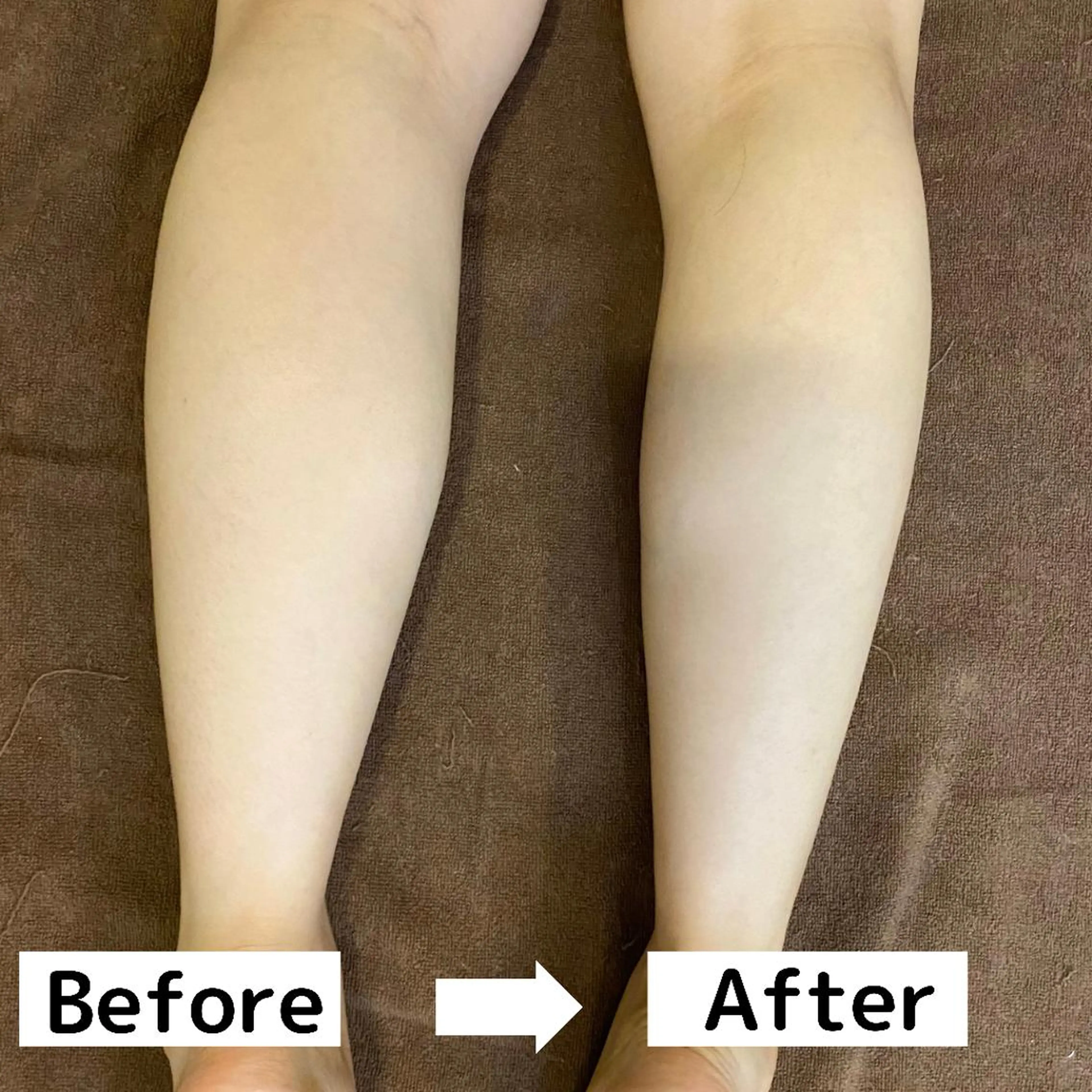 ふくらはぎ 痩せを細くスッキリさせる⭐️ゴリゴリ固まった足、浮腫み、疲れ足の方もおすすめ(足裏・膝​〜​足首)の写真
