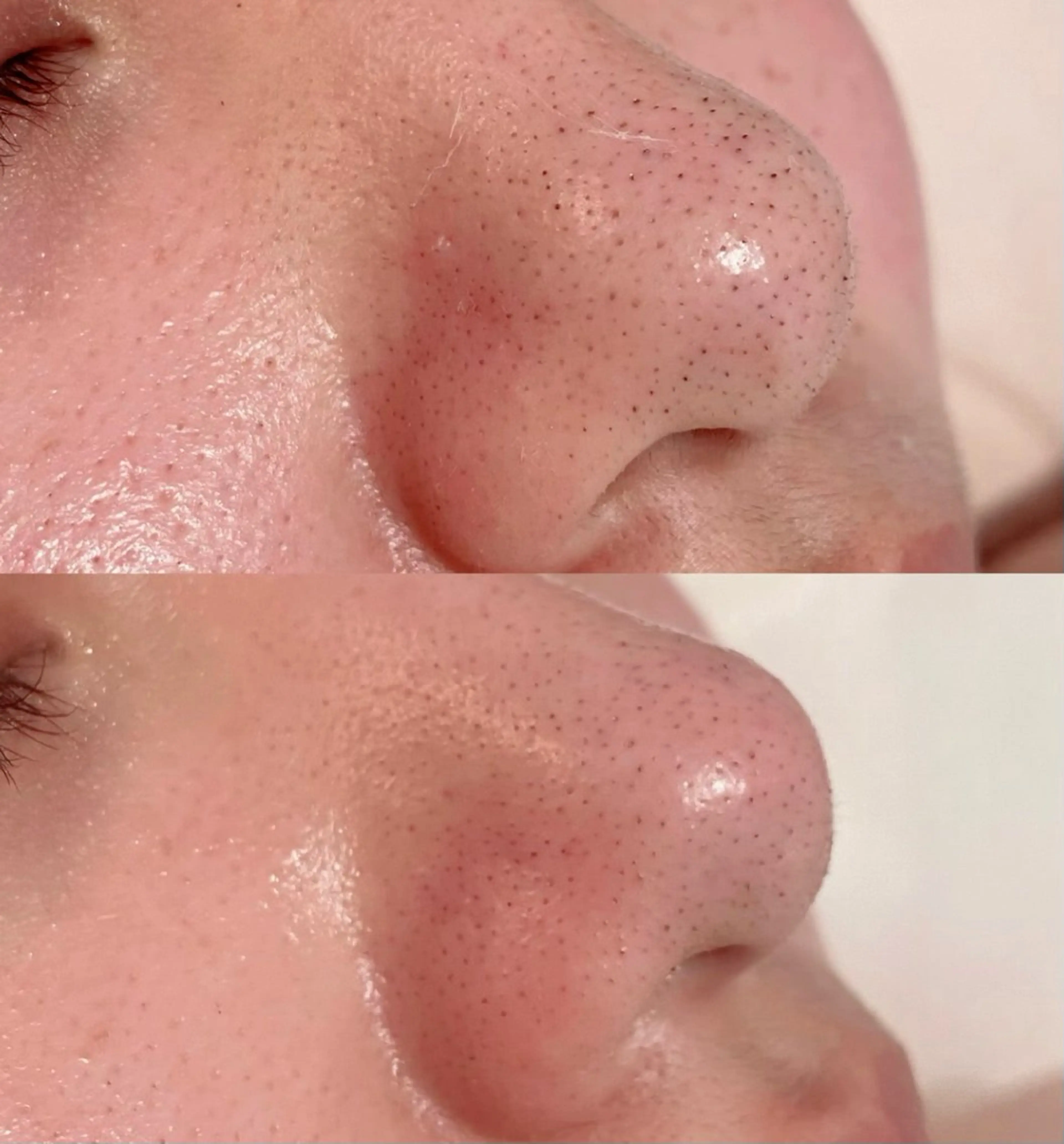 mignon /まつげパーマ・小顔のエステ・リラクイメージ