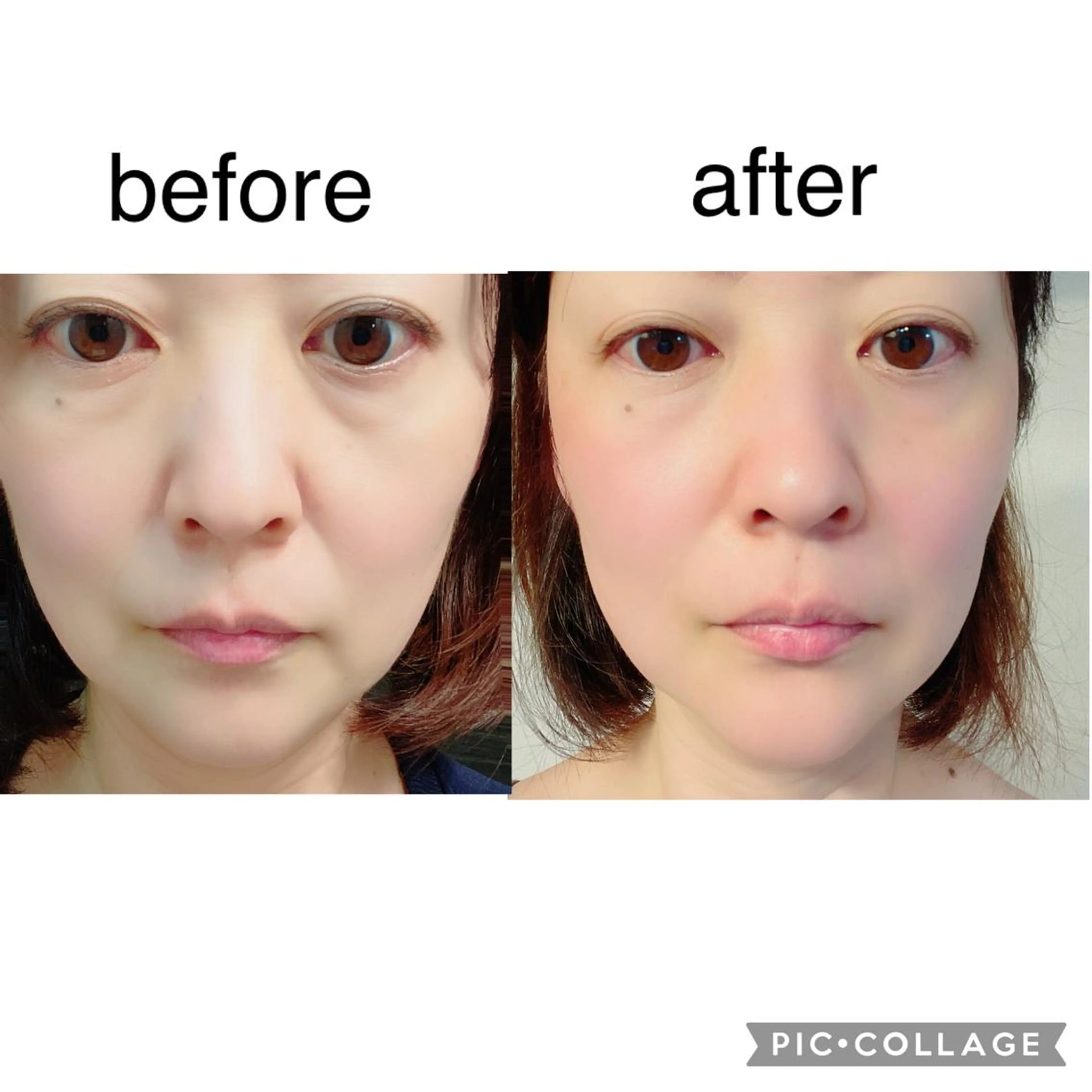 エステ 伊藤 順子のその他イメージ