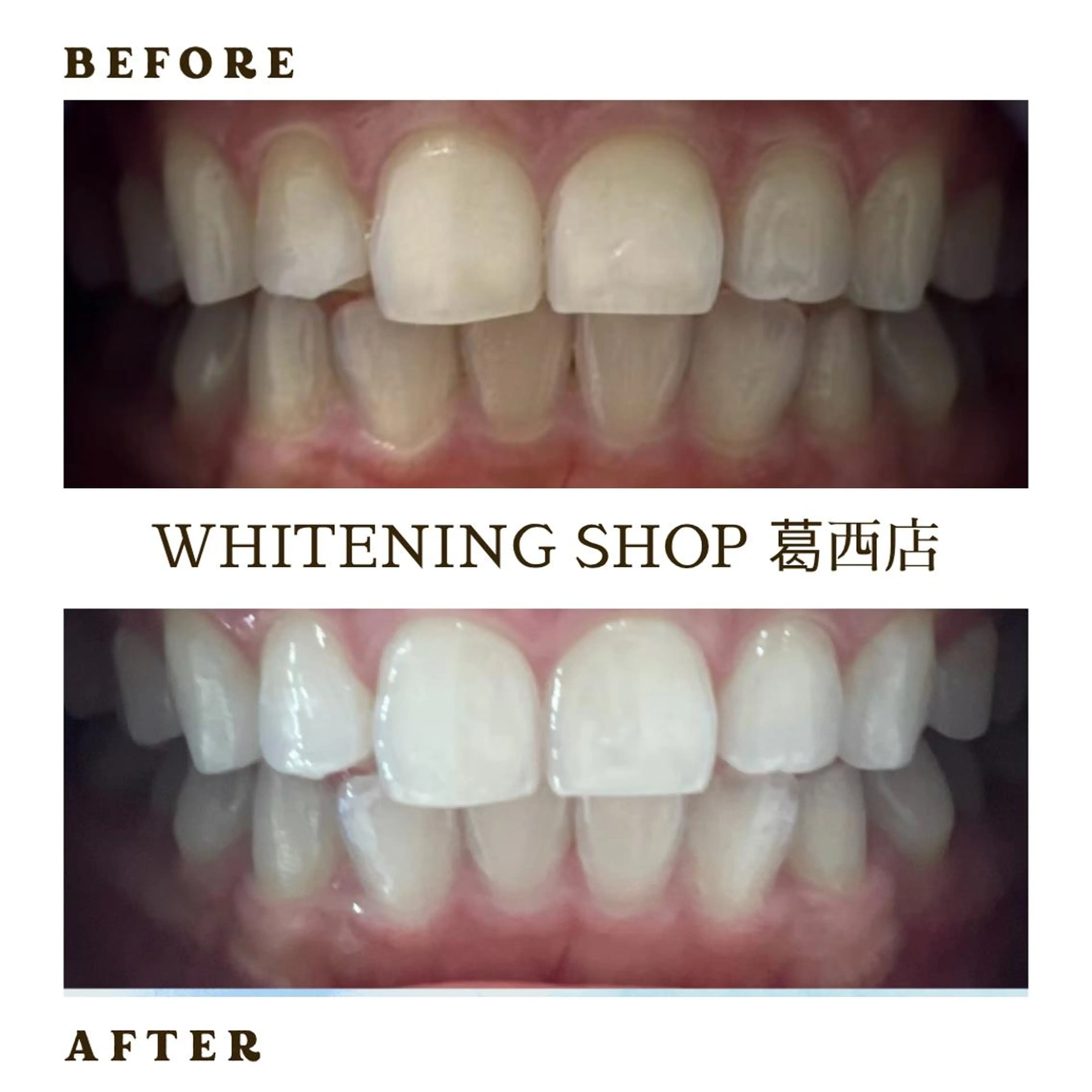 メンズ その他 ホワイトニング ショップ葛西店のその他イメージ