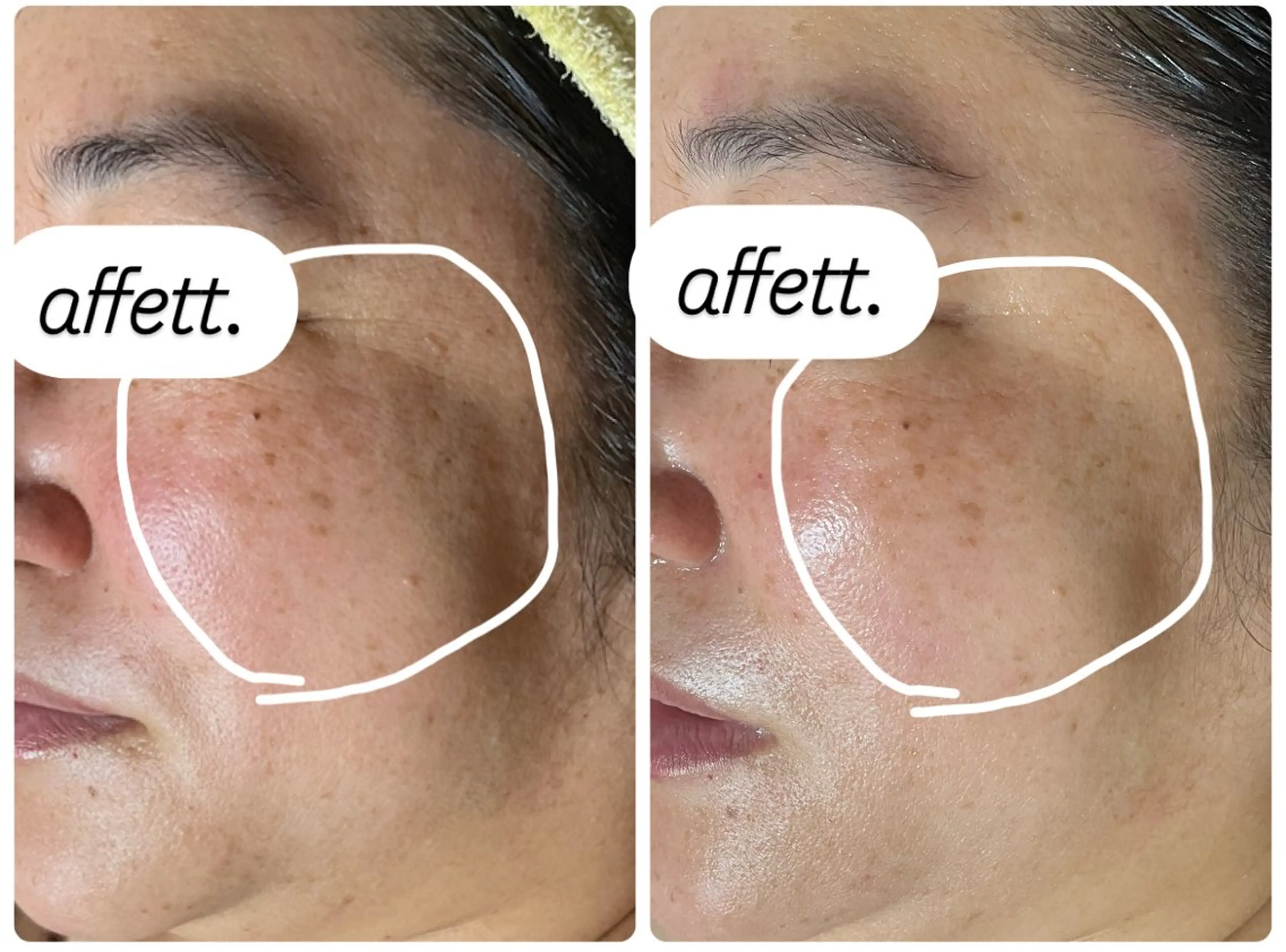 エステ 澤井 千晴のエステ・リラクイメージ