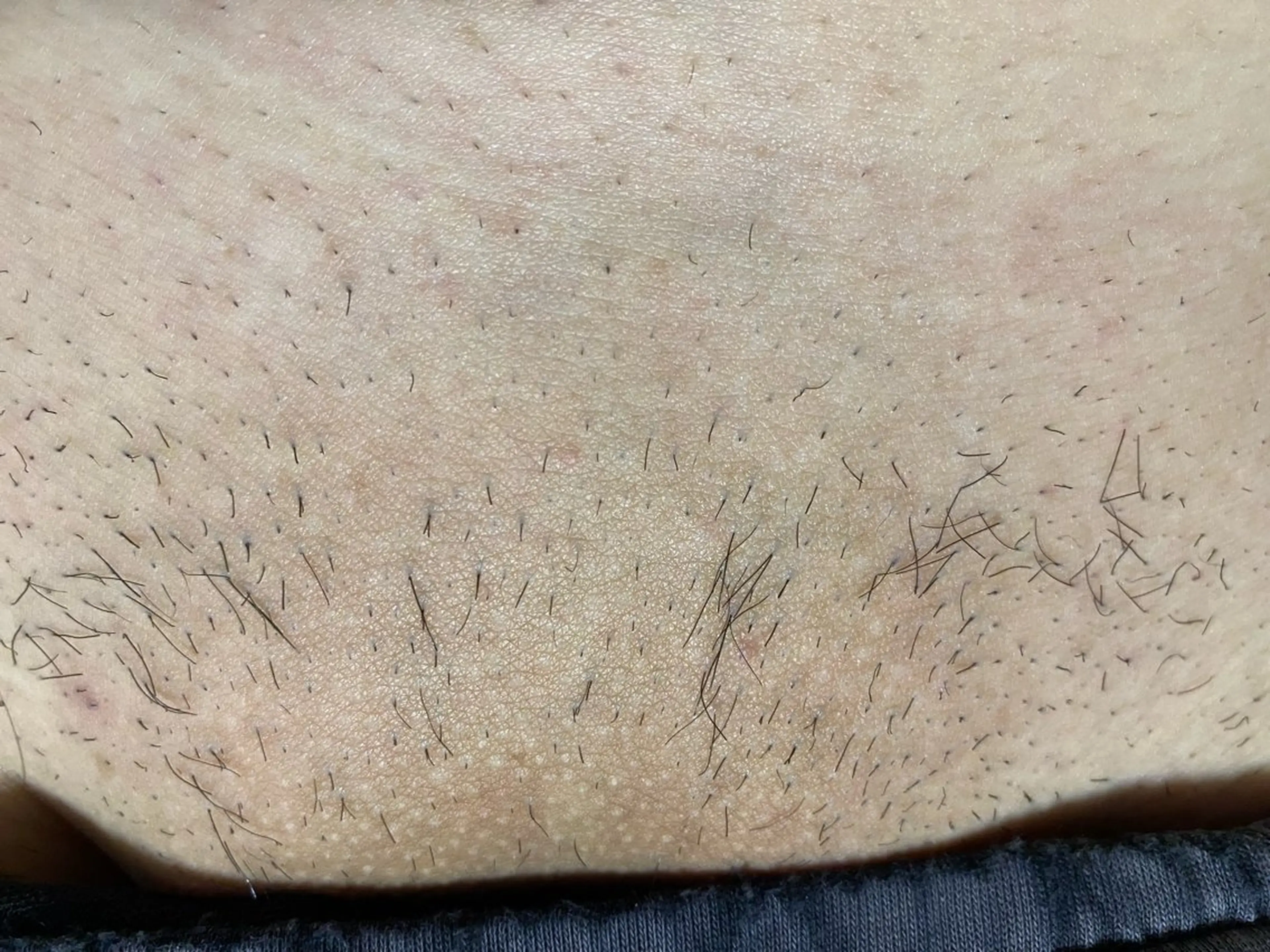 メンズ 脱毛 Beauty  Studio CARO所属・ビューティースタジオ カーロのその他イメージ