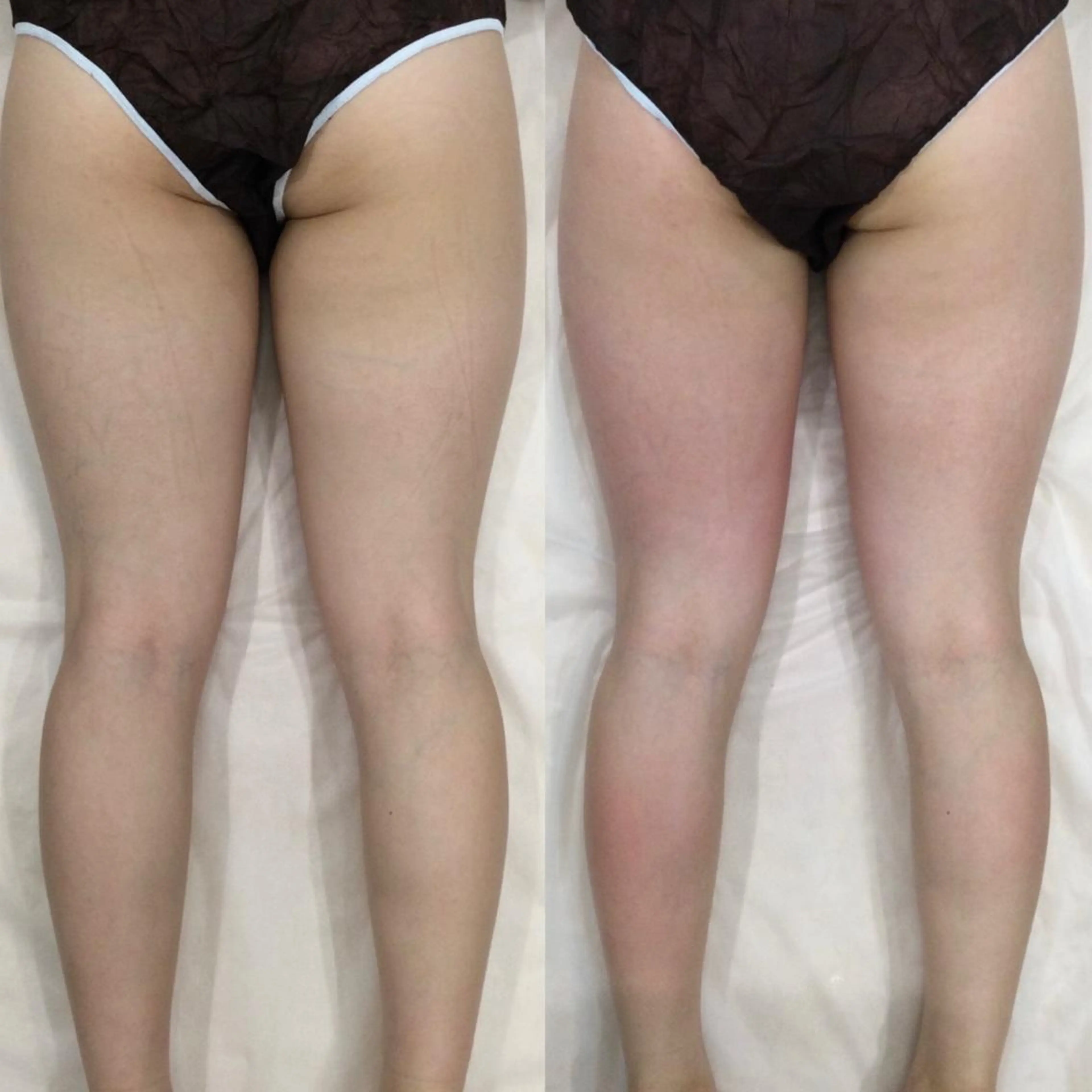 ファッショニスタ yaeのエステ・リラクイメージ