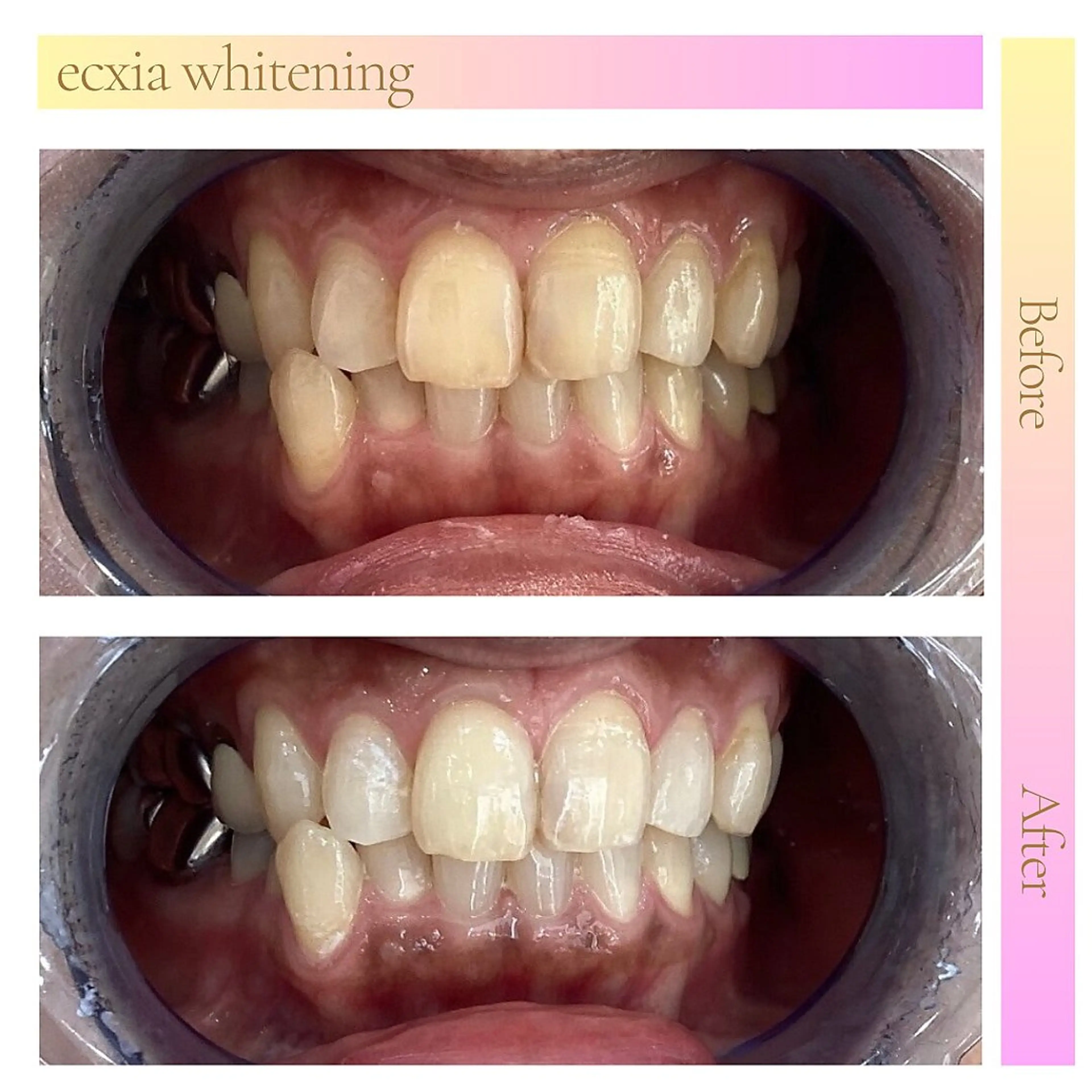 エクシアホワイト名古屋名駅所属・エクシアホワイト Reiのその他イメージ