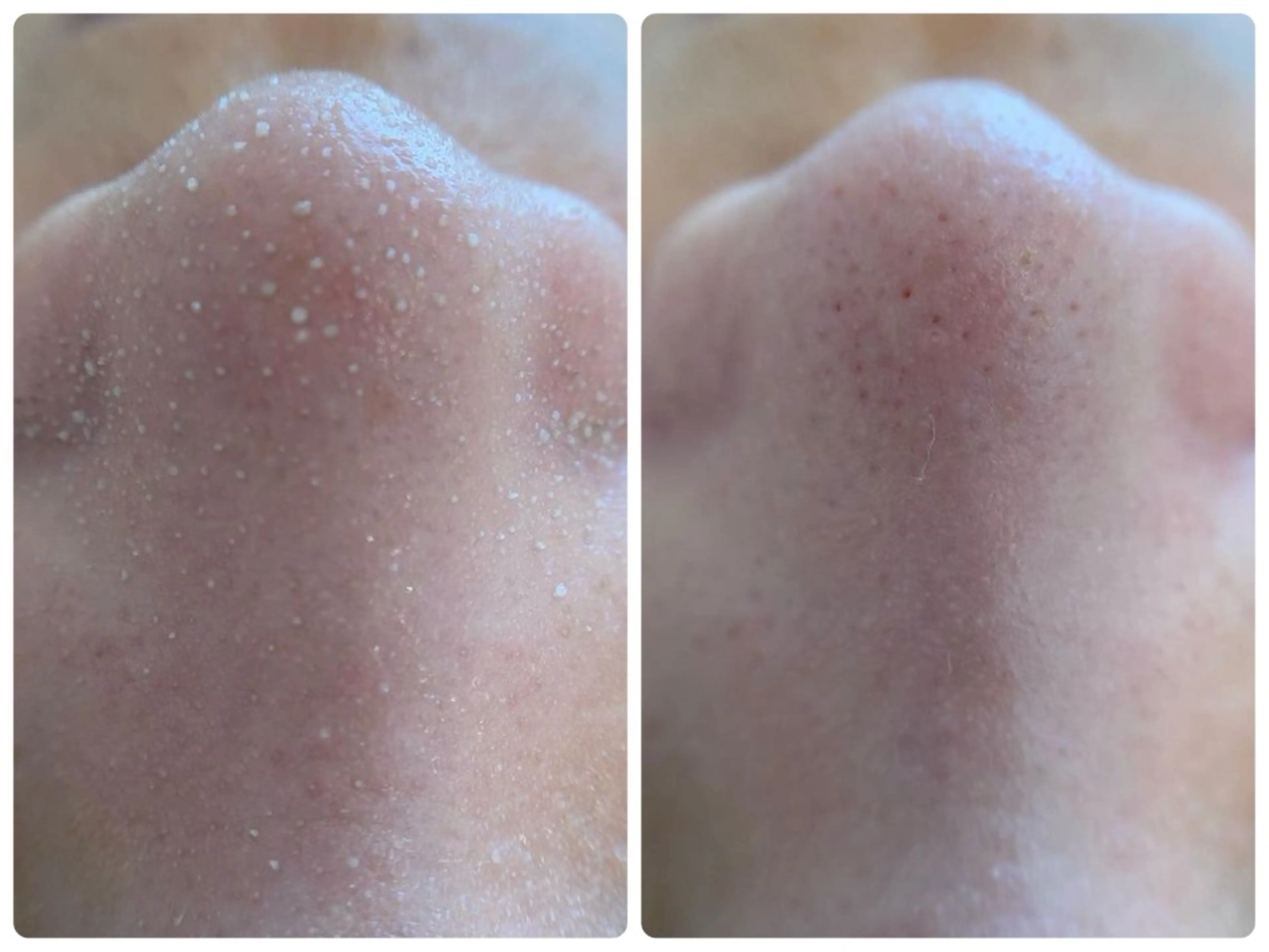 エステ Hisui 小出のエステ・リラクイメージ