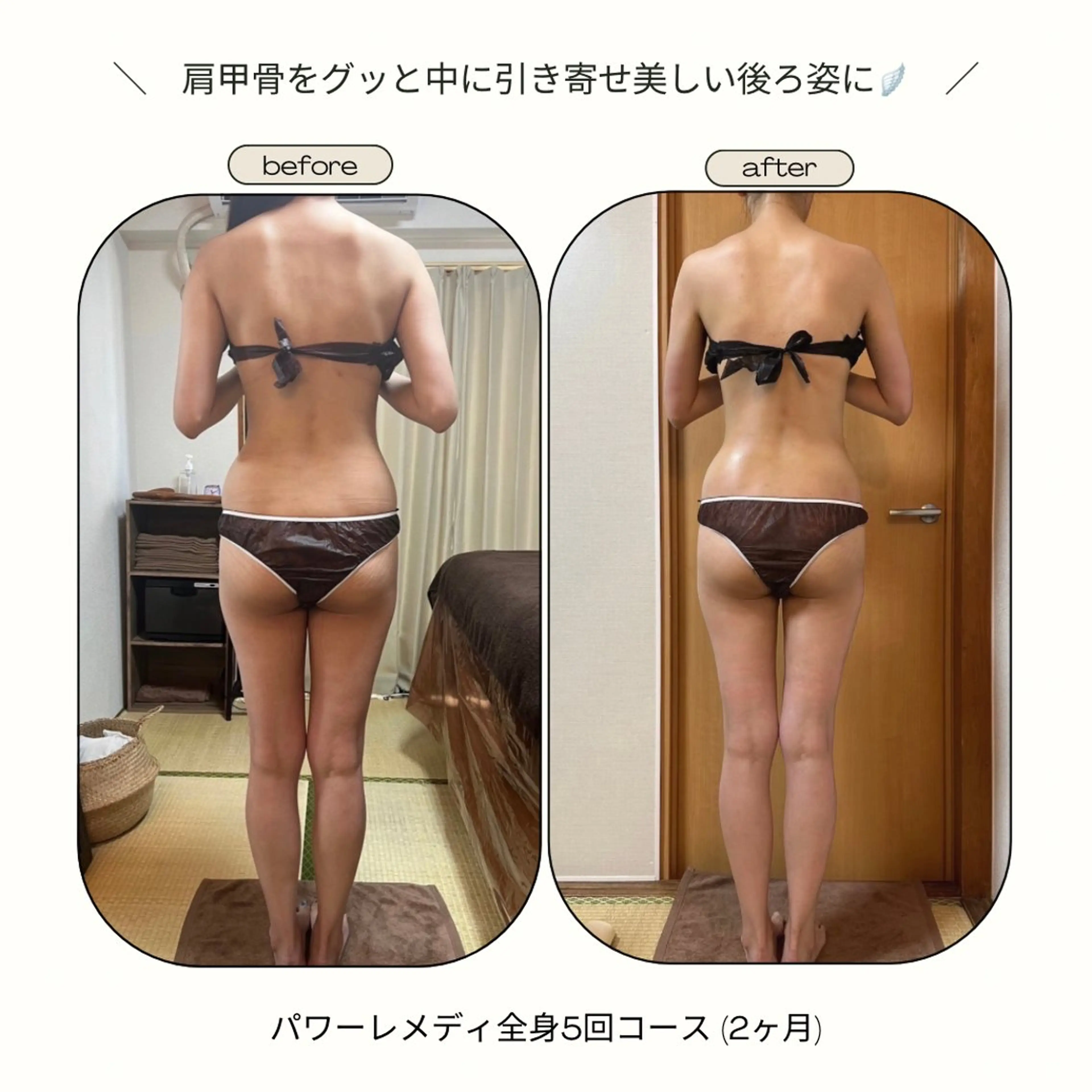 《本気痩せ×疲労改善 》  BILOOPのエステ・リラクイメージ