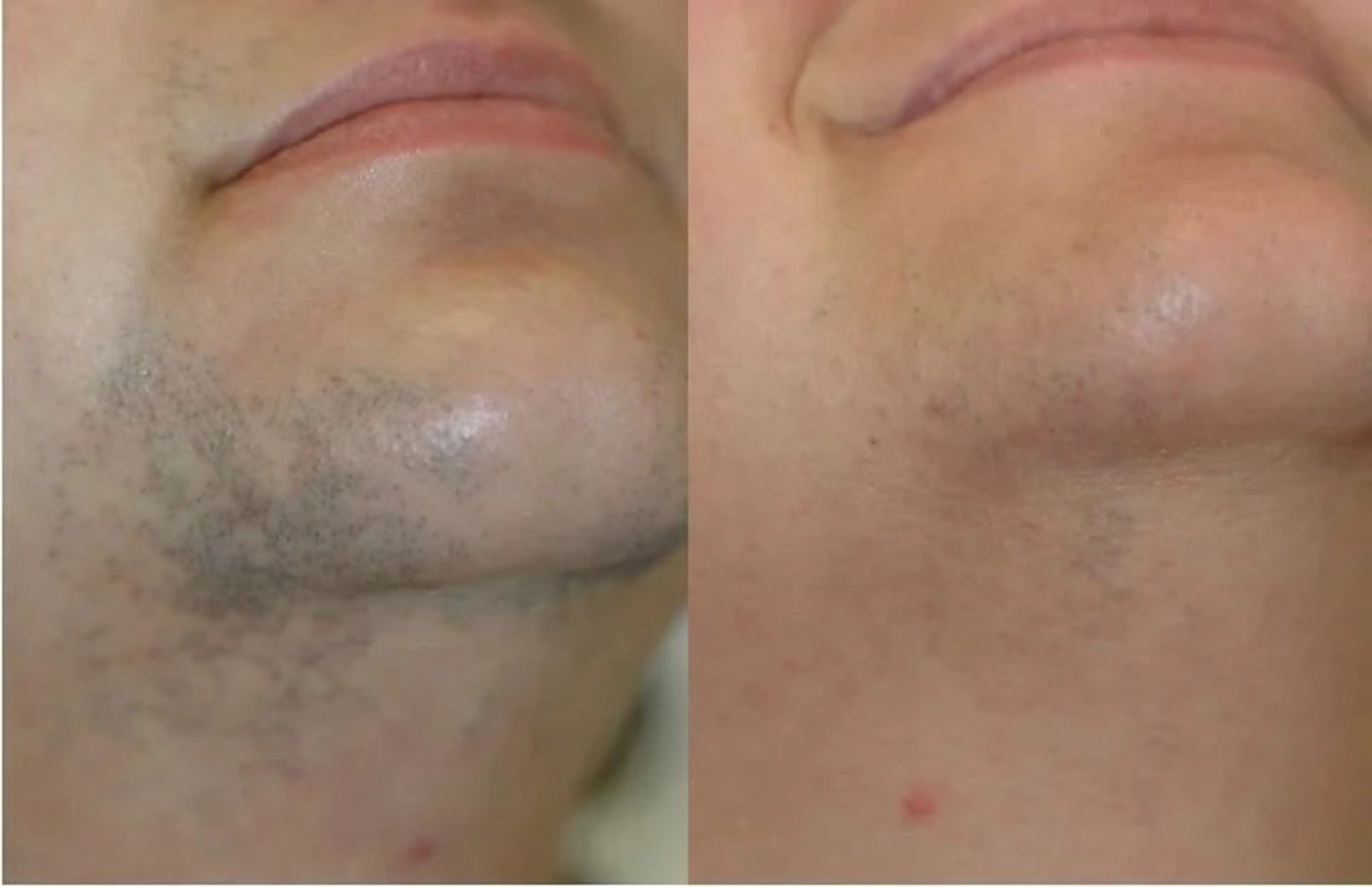 メンズ美肌脱毛 seekest.のエステ・リラクイメージ