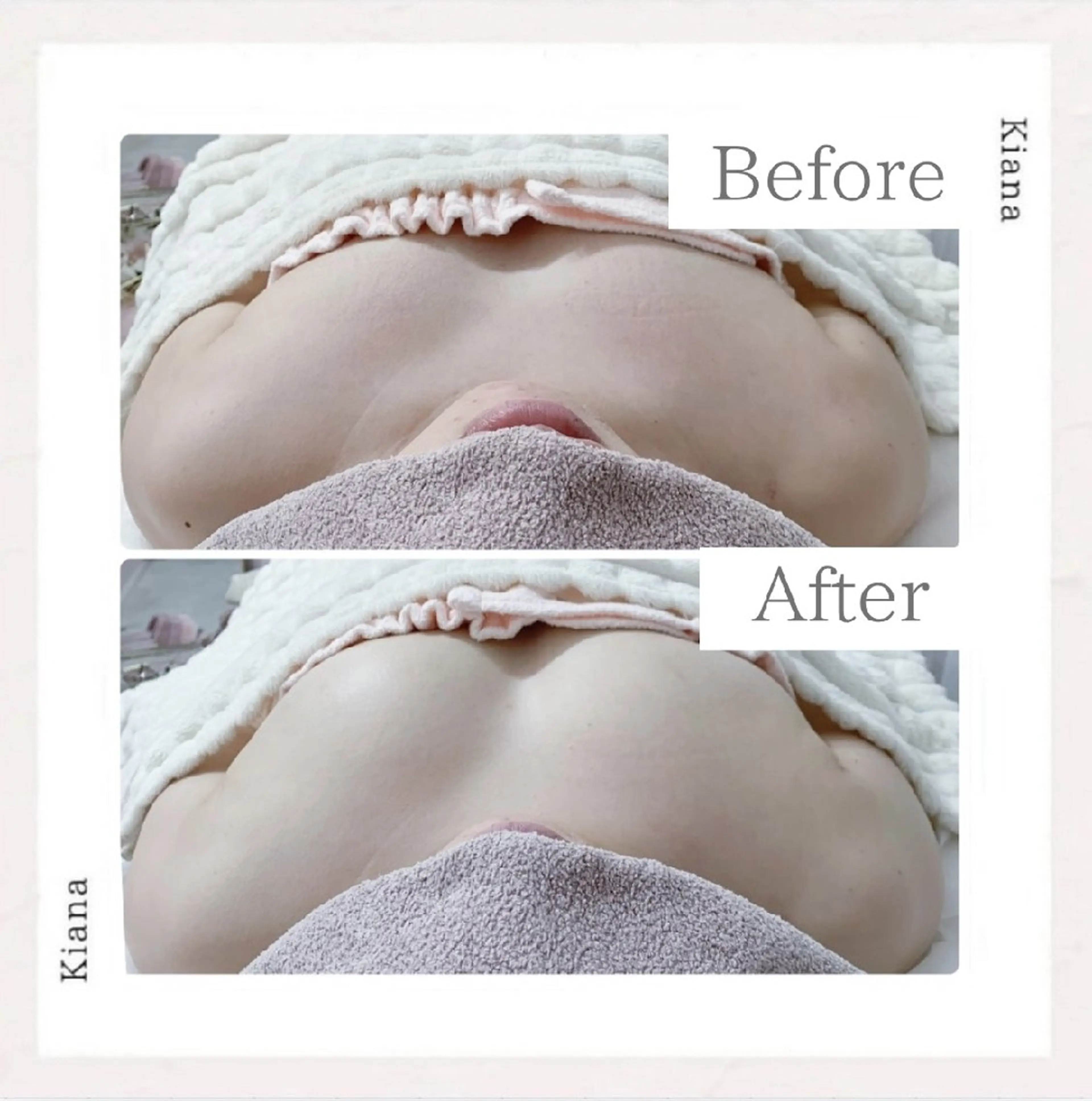 エステ リラク 【バスト専門店 】 Kiana のエステ・リラクイメージ