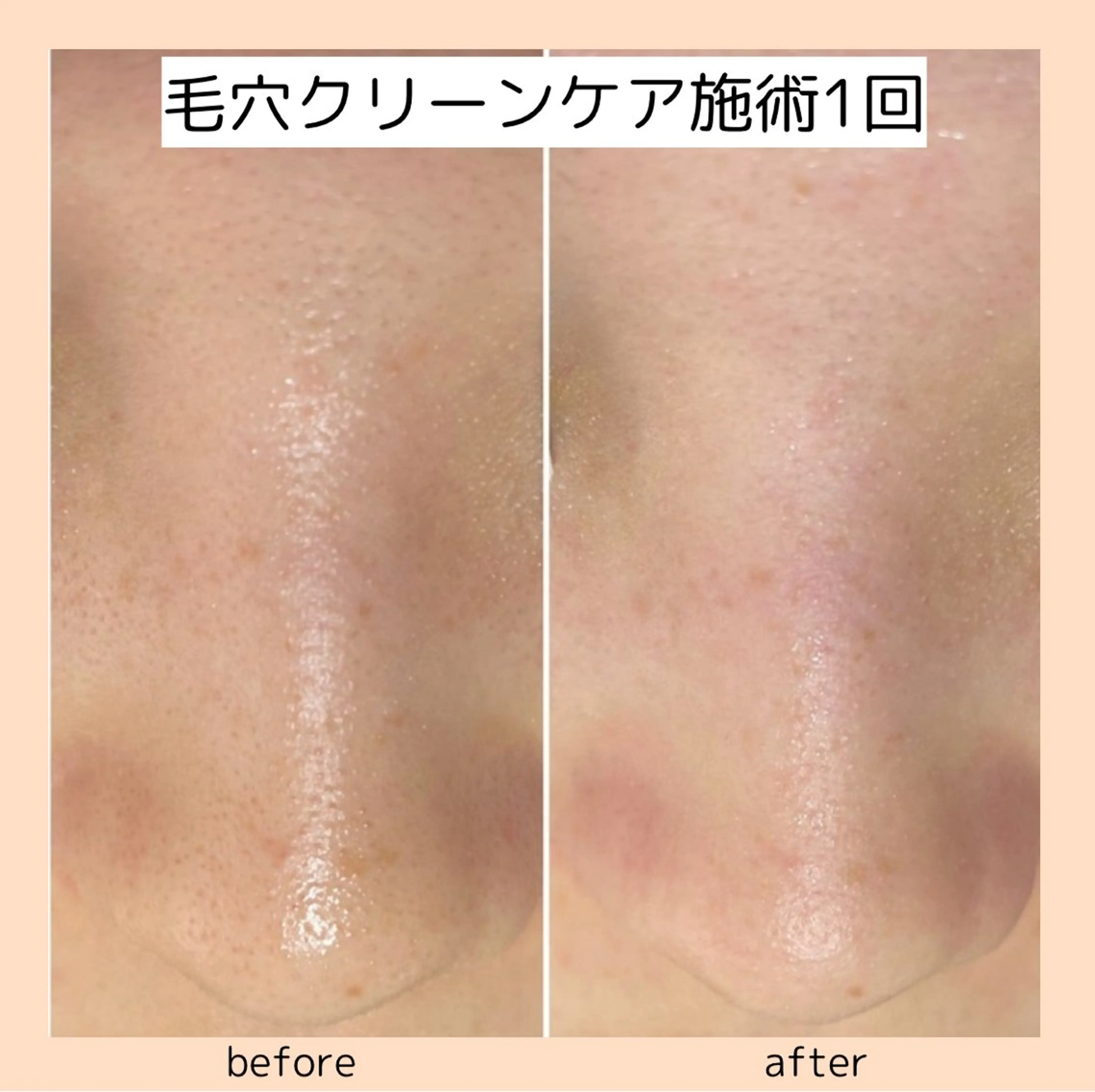 three ﾜﾀﾅﾍﾞのエステ・リラクイメージ