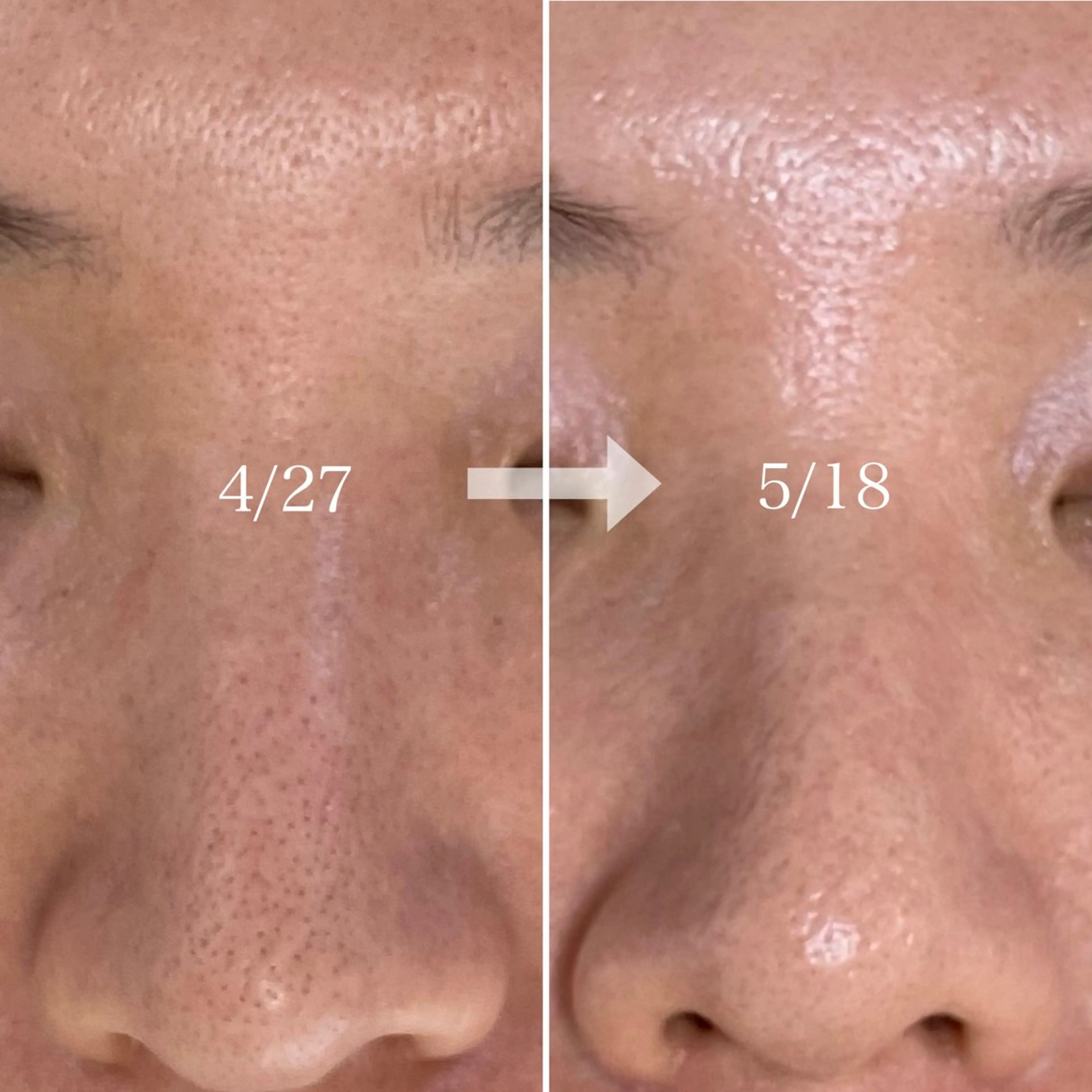 ニキビ・毛穴・ フェイシャル専門店のエステ・リラクイメージ