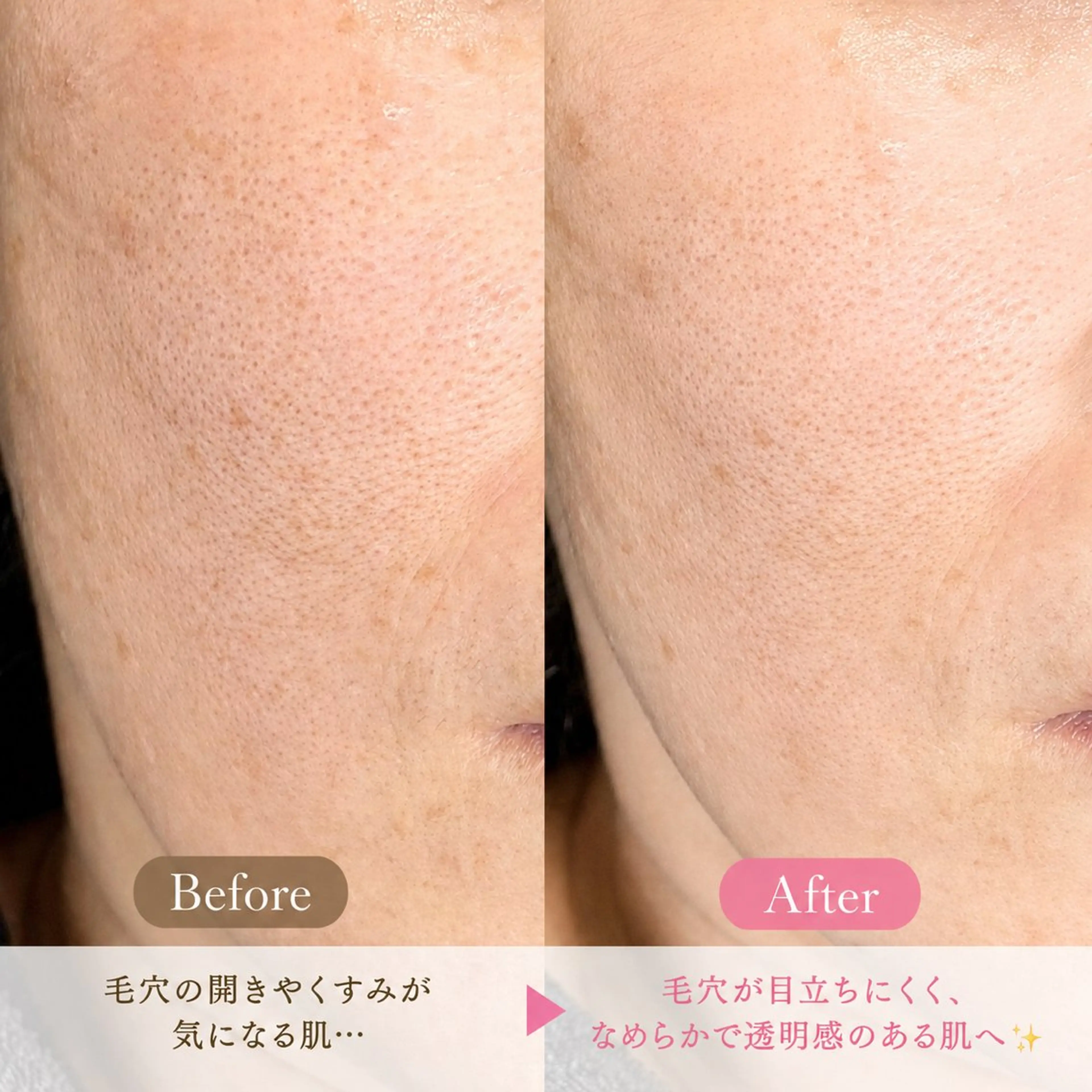 エステ Balance facialのエステ・リラクイメージ