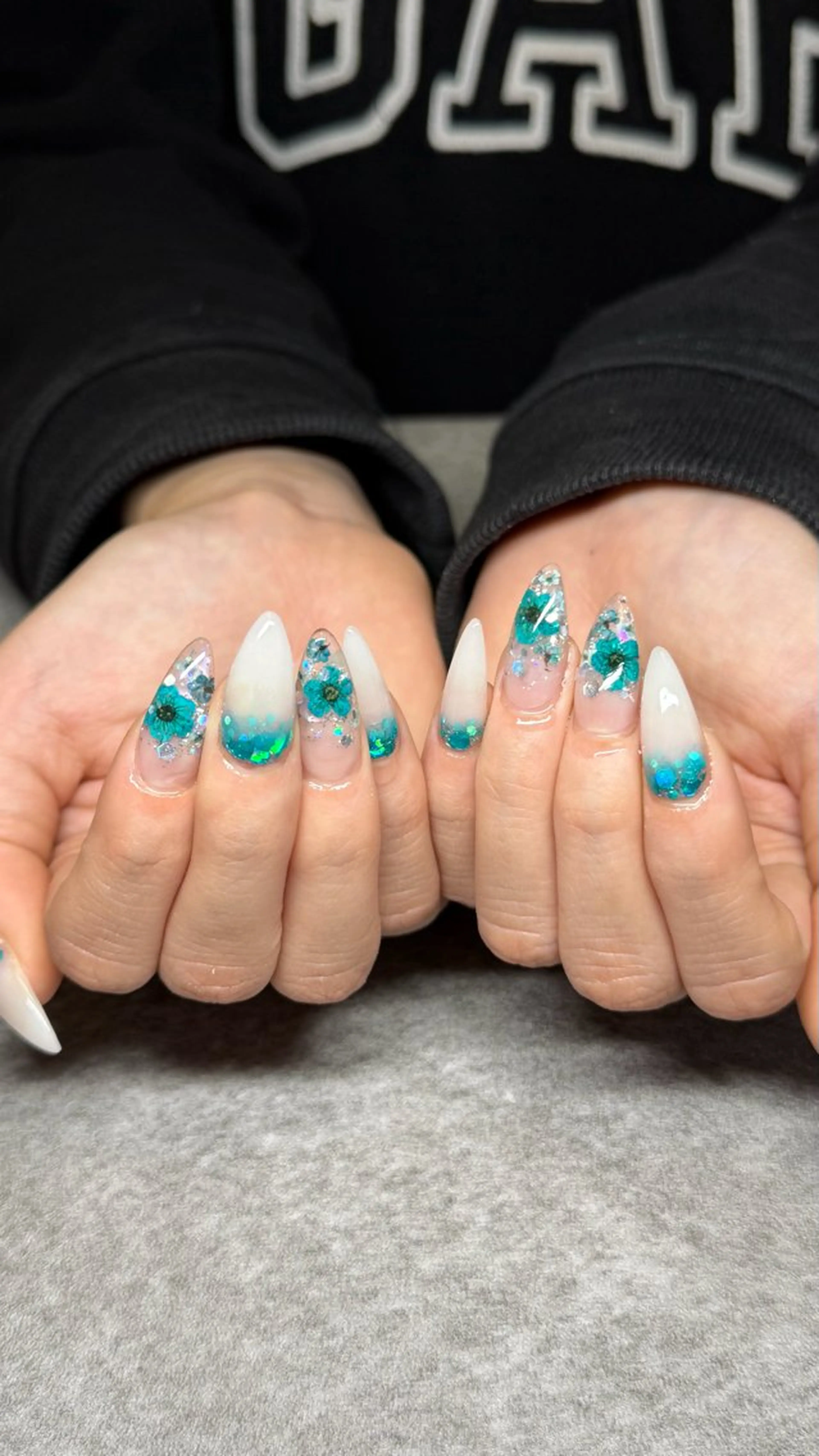 "期間限定"スカルプ持ち込みデザインの写真