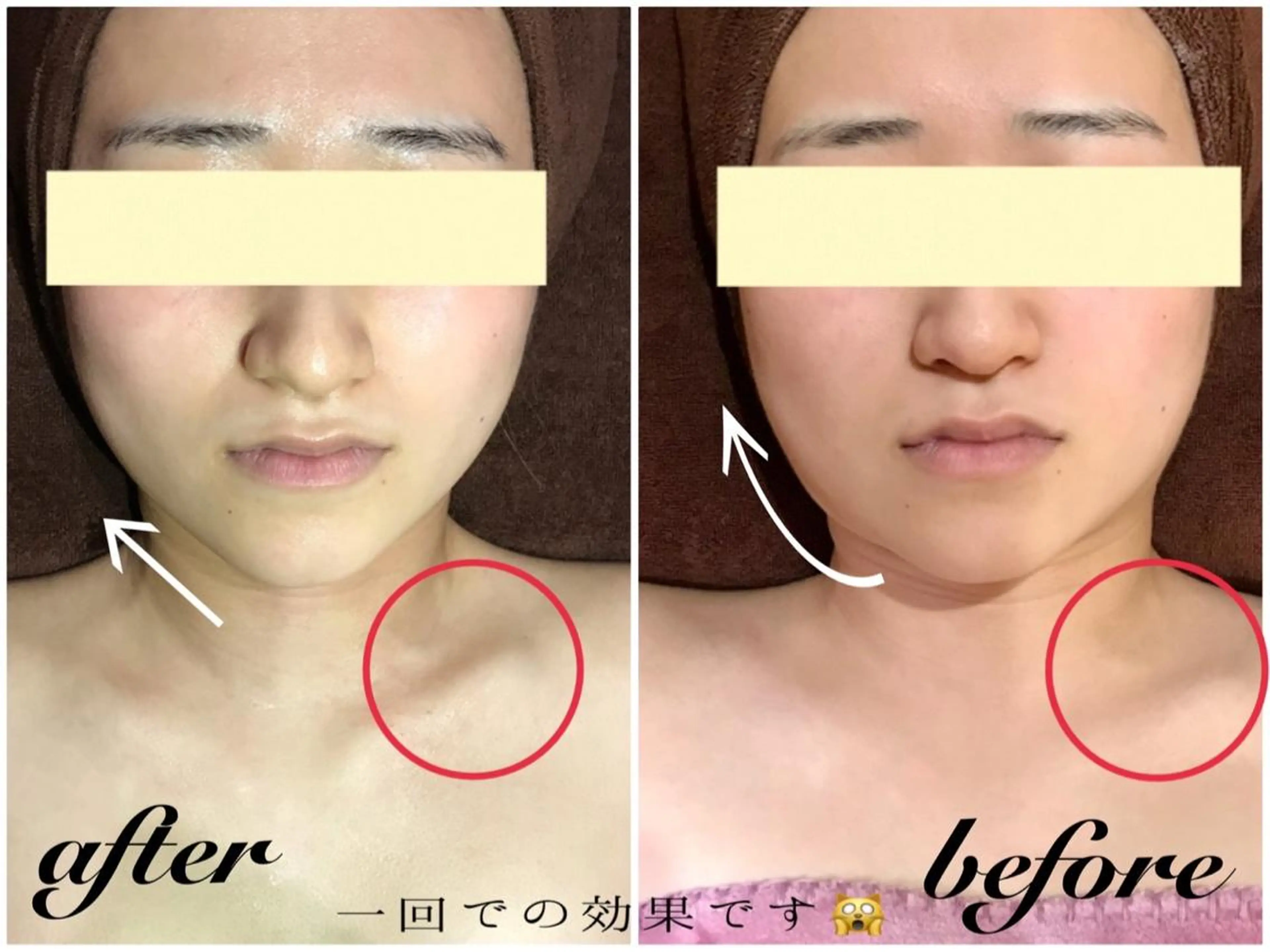 うなじ/もみあげ脱毛 ヴィシェーン佐藤のその他イメージ