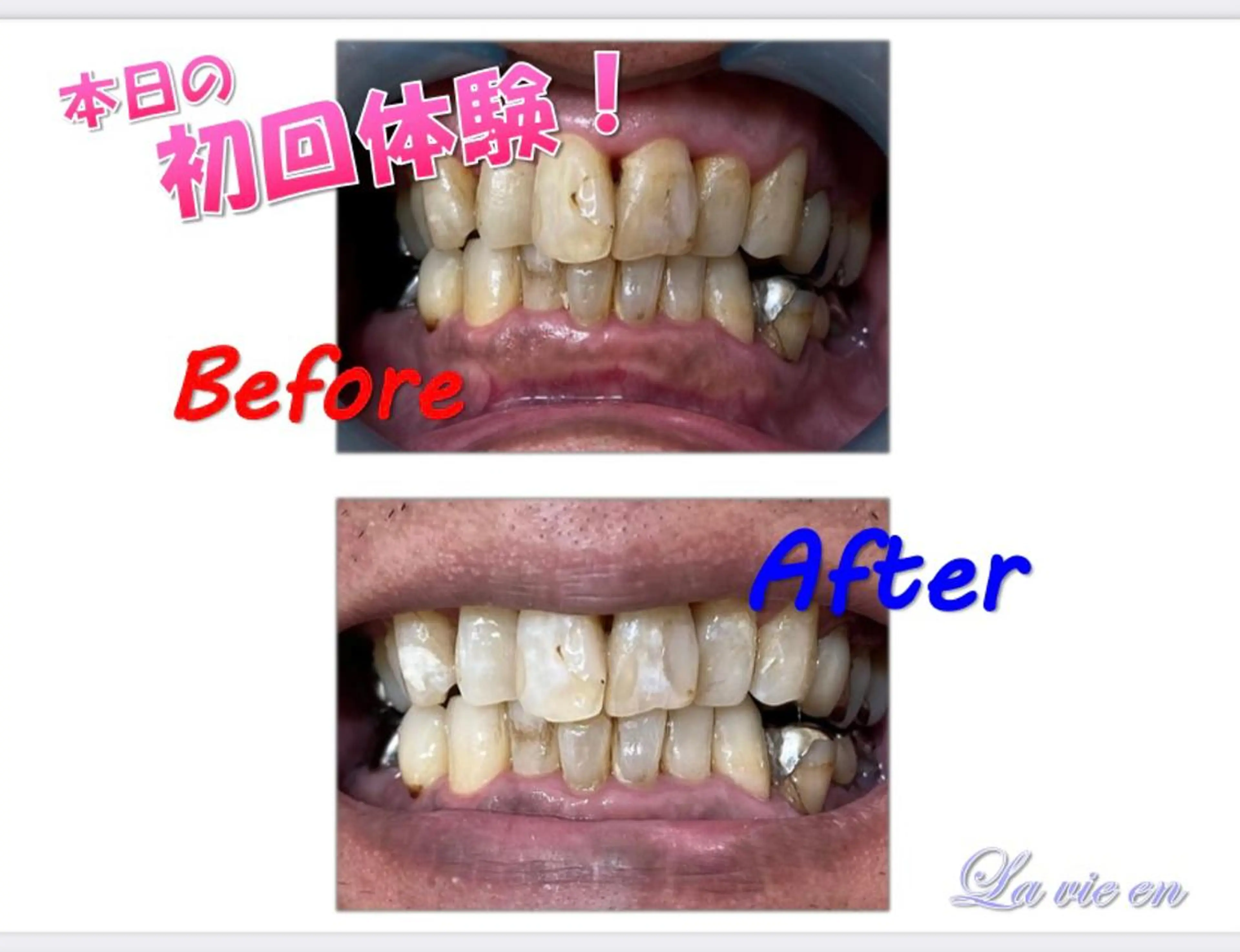 その他 ホワイトニングサロン La vie enのその他イメージ