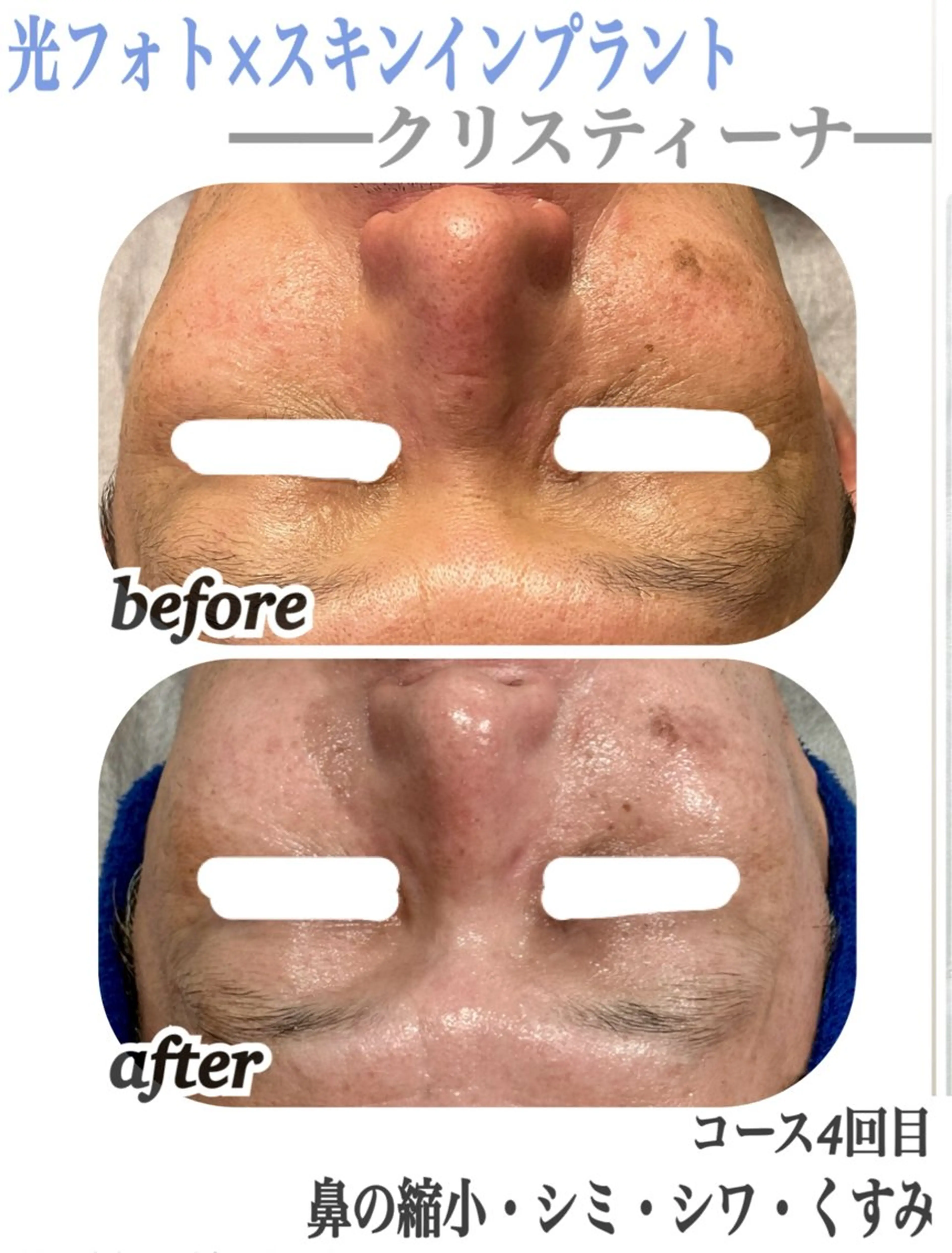 肌質改善/都度脱毛 Mahinaのエステ・リラクイメージ