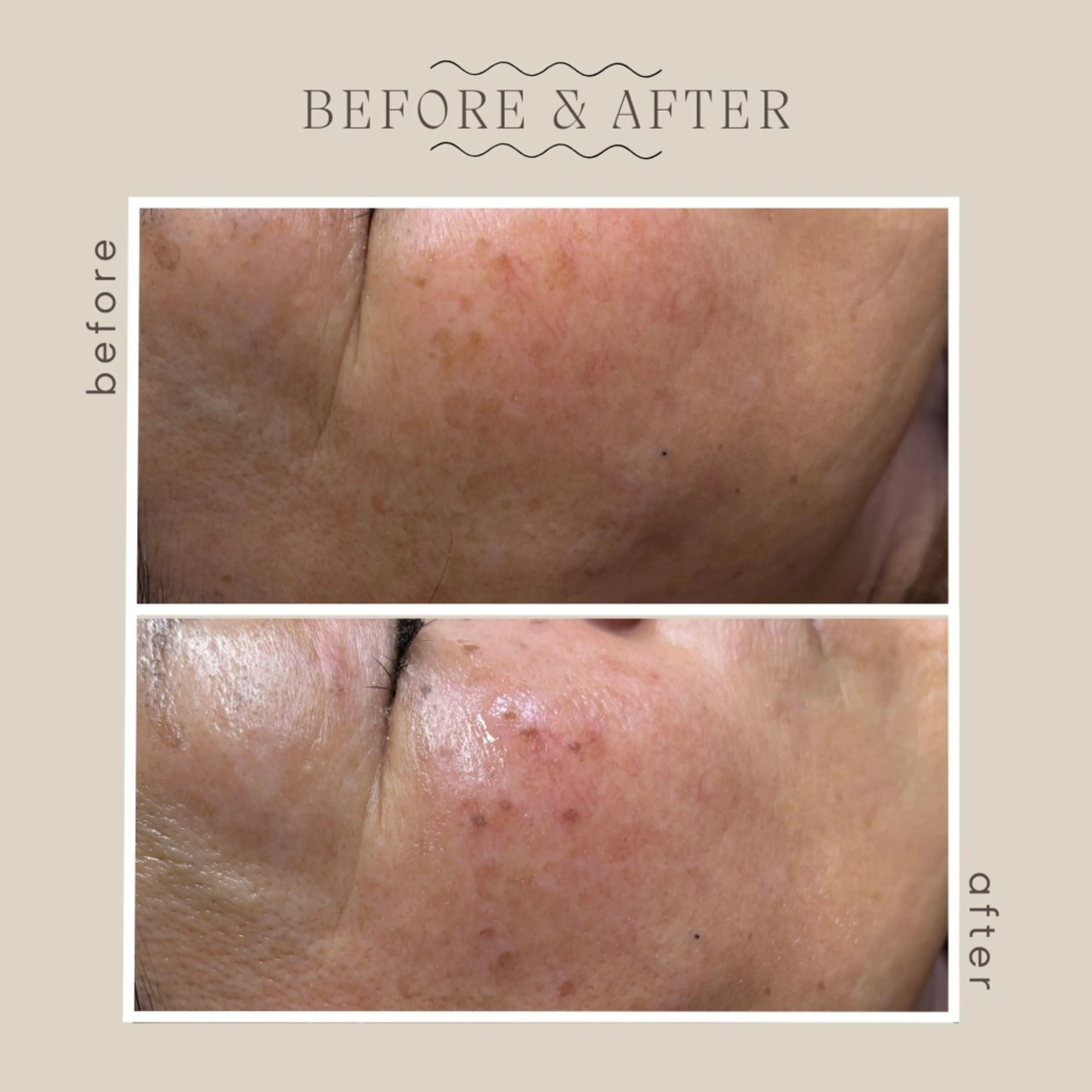 エステ emiluka beautyのエステ・リラクイメージ