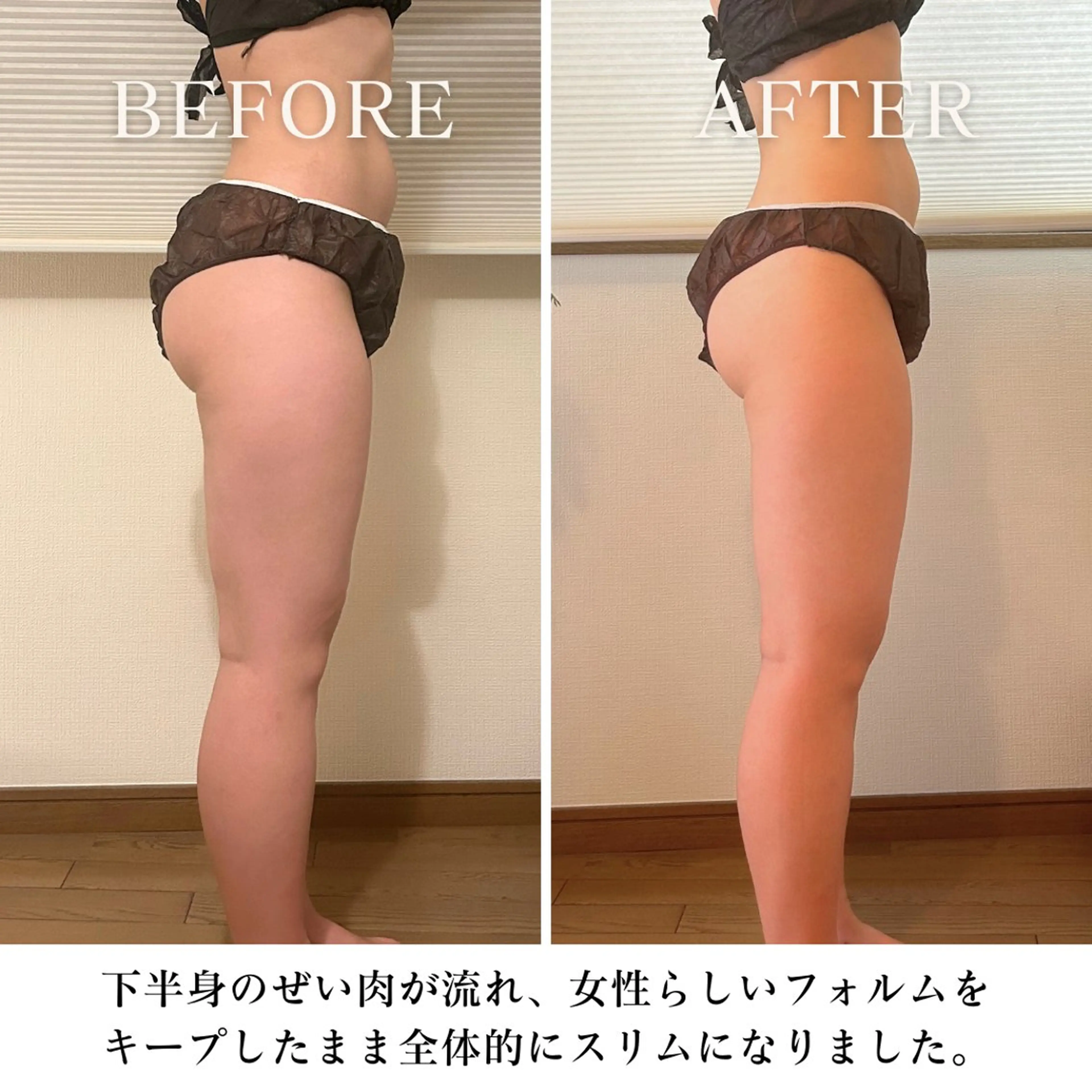 【目黒】本格痩身✴︎ 最新型よもぎ蒸しのエステ・リラクイメージ