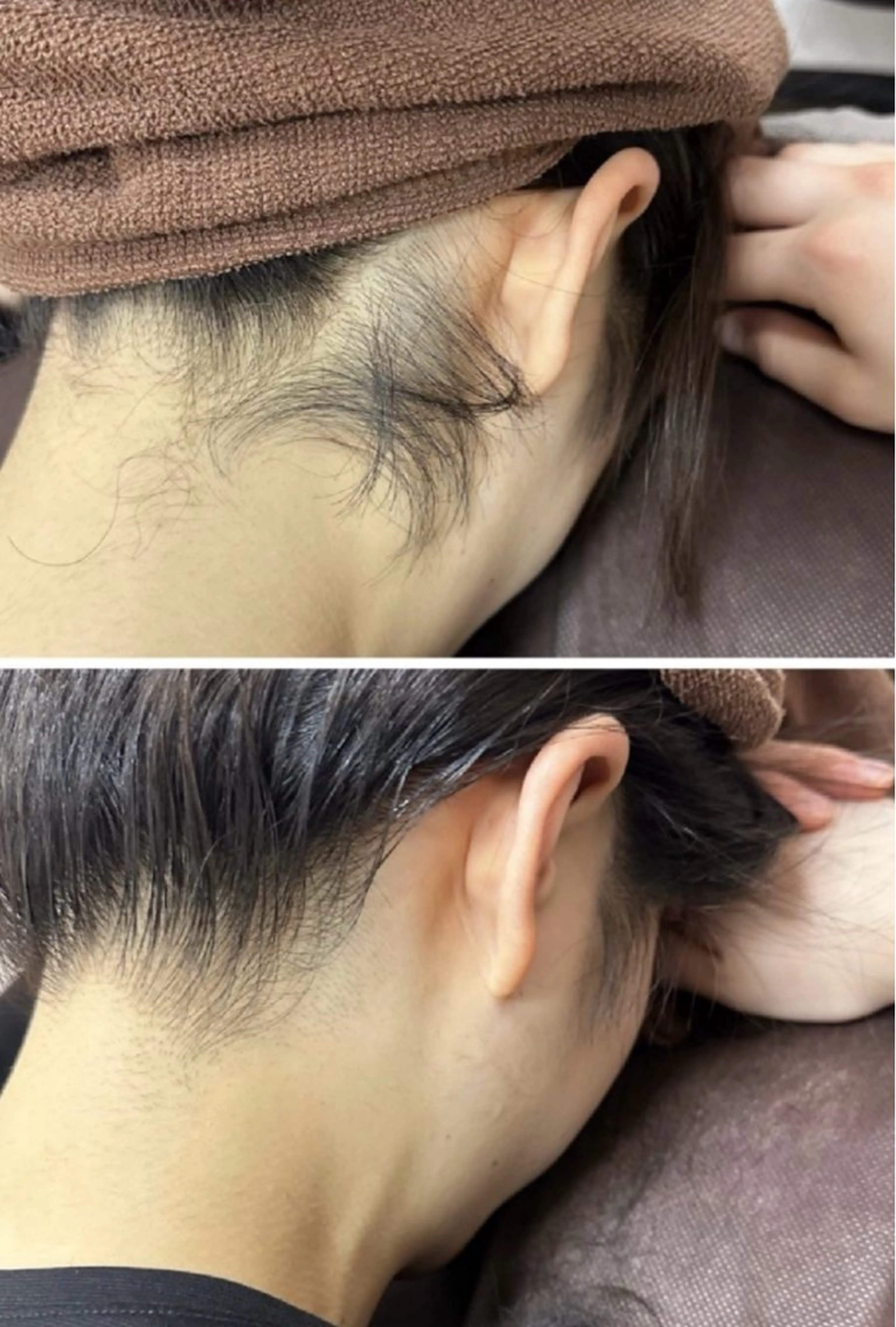 脱毛 韓国肌管理×毛穴 改善専門🤍nanaのエステ・リラクイメージ