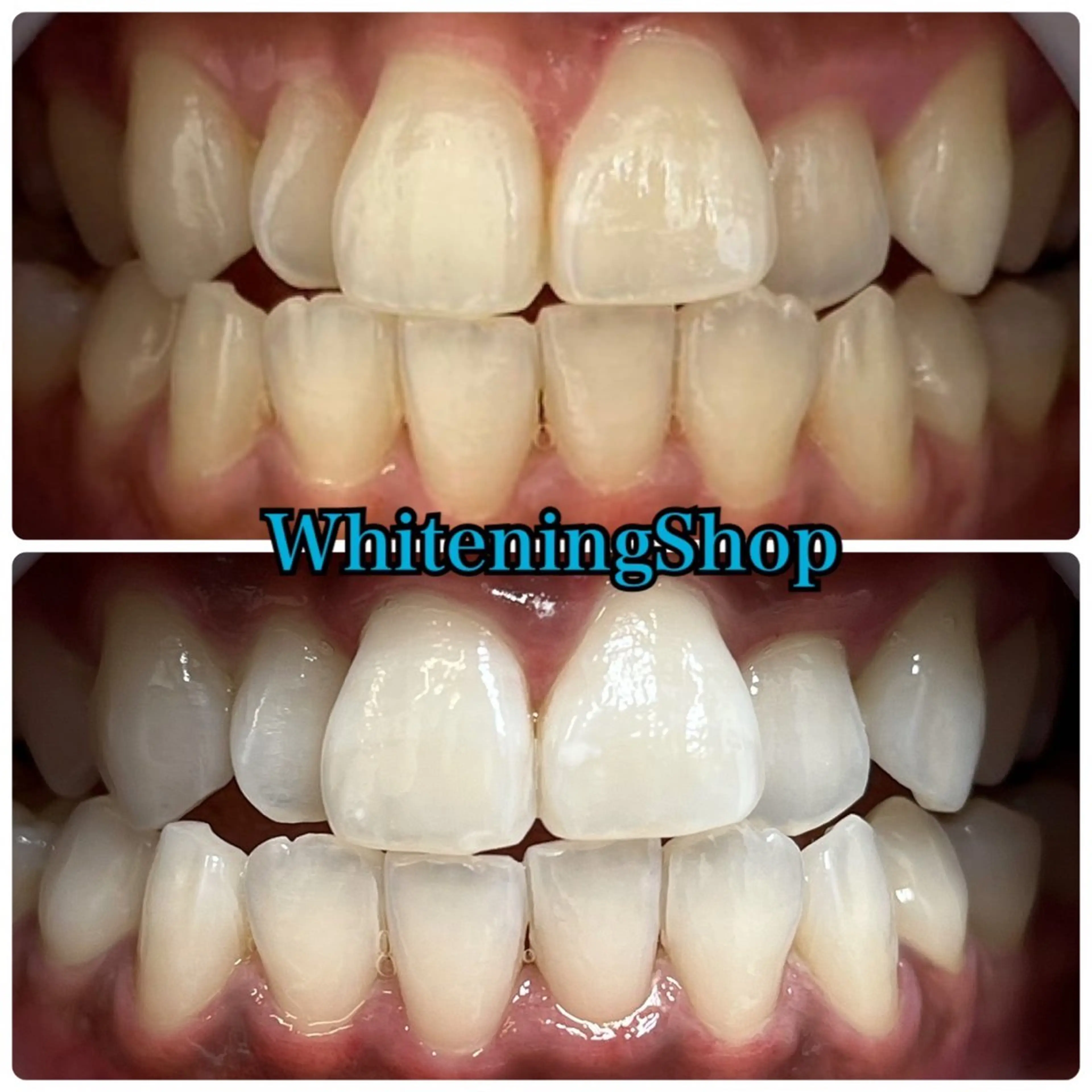 エステ リラク ホワイトニング ショップ吉祥寺店のエステ・リラクイメージ