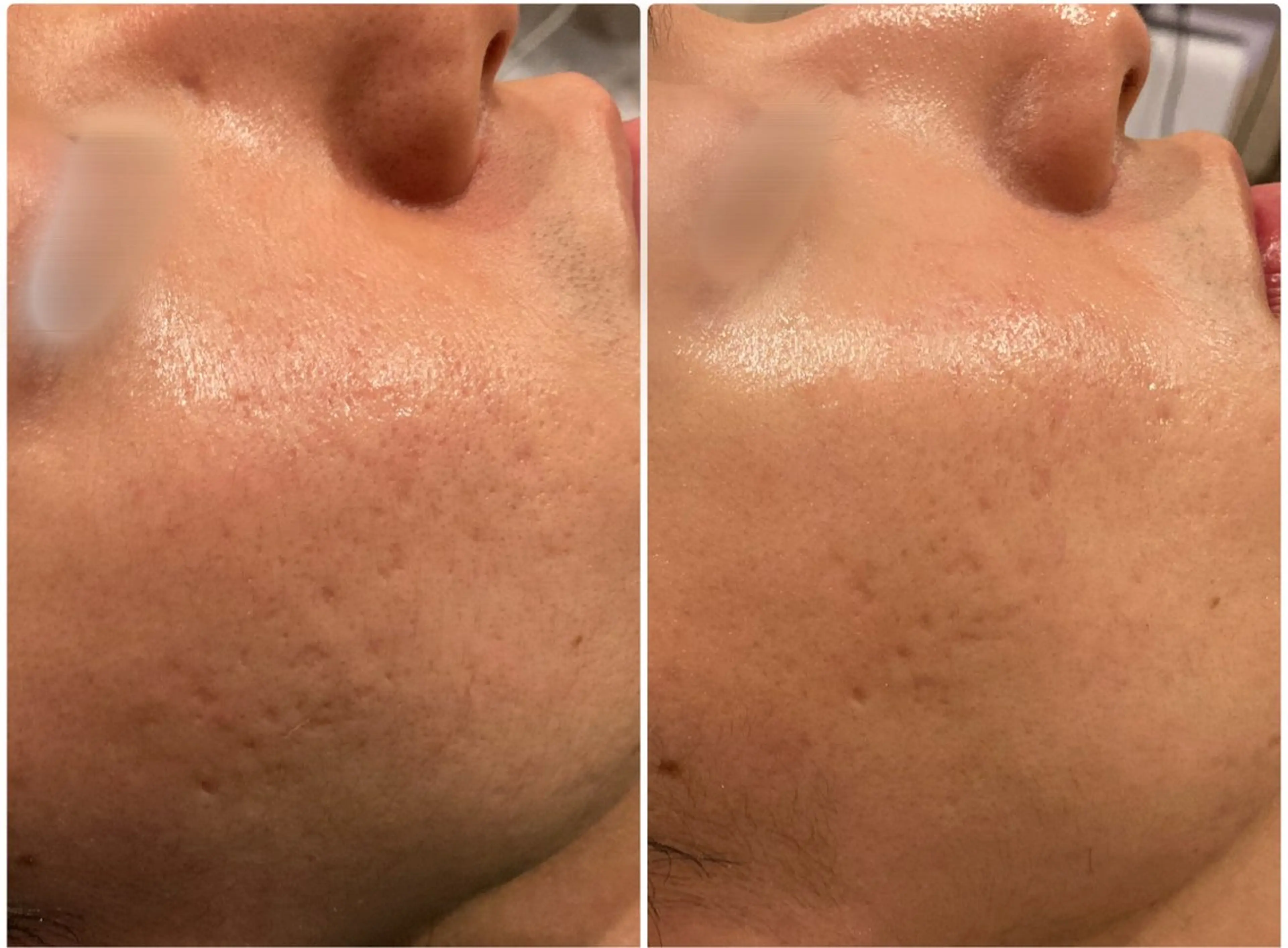 肌育専門ナース❗️ みのり／ナスサロのエステ・リラクイメージ