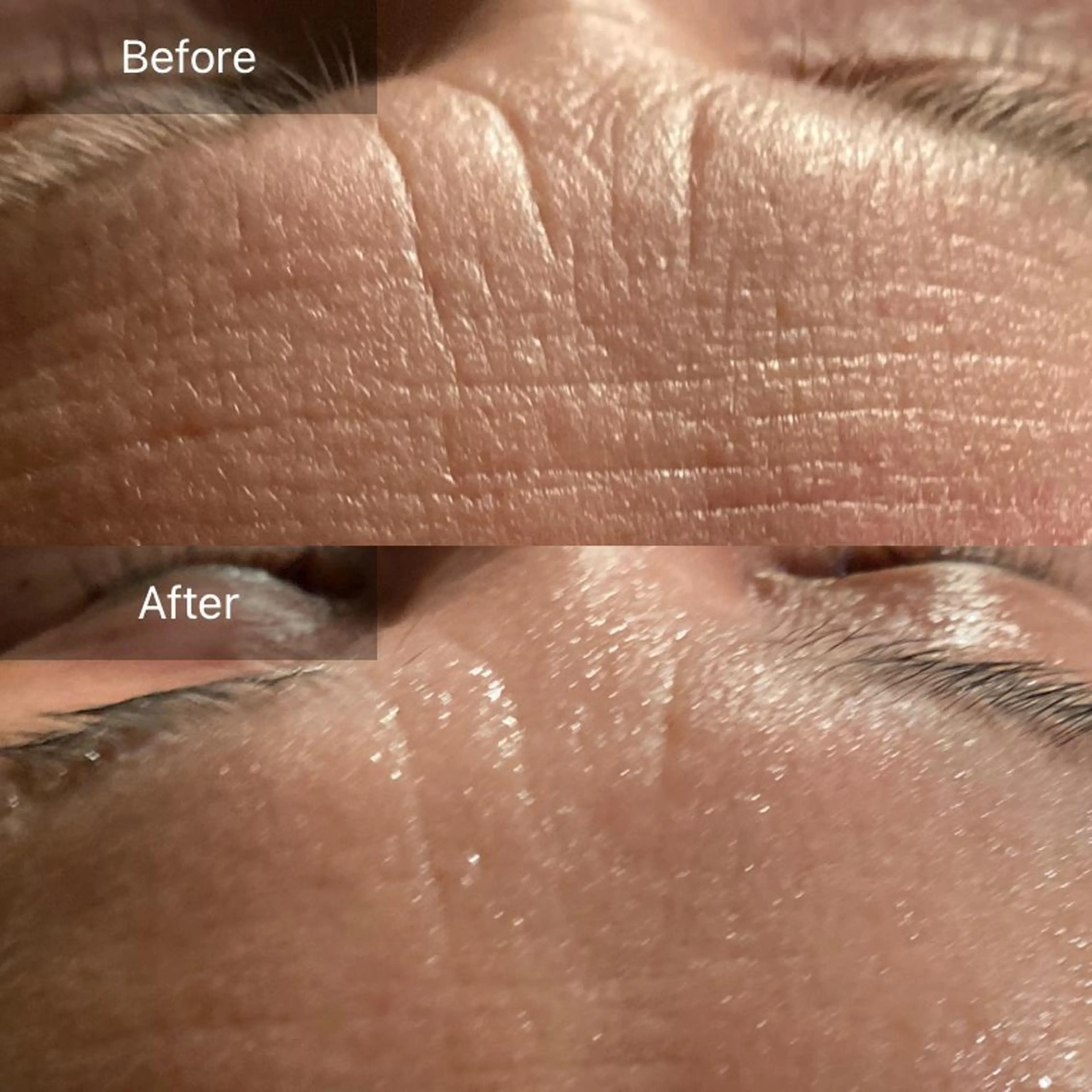 Mandarin Orange所属・毛穴から始める肌メン テマンダリンオレンジのエステ・リラクイメージ