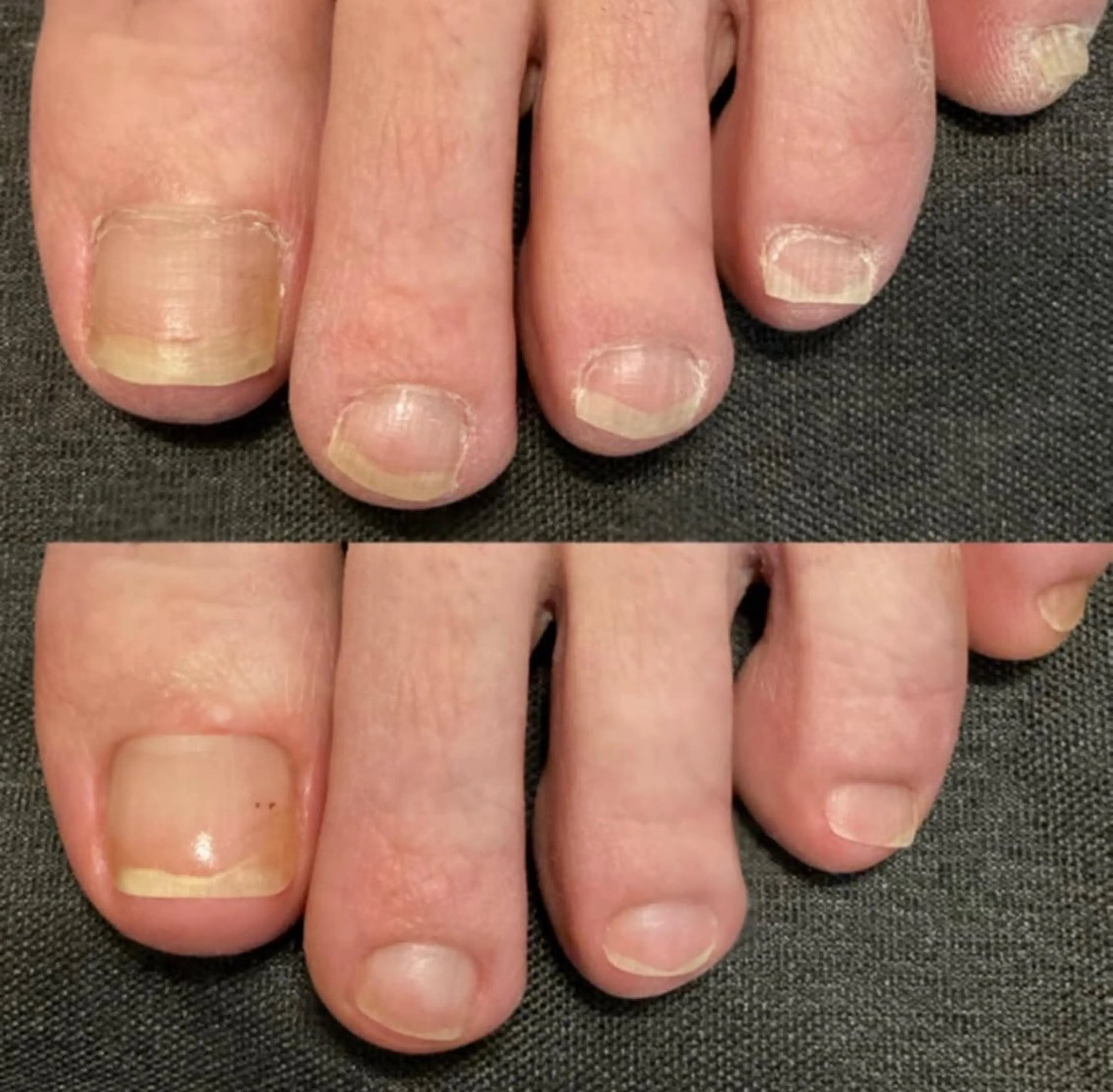 ネイル フットネイル kanaoa nailのネイルデザイン