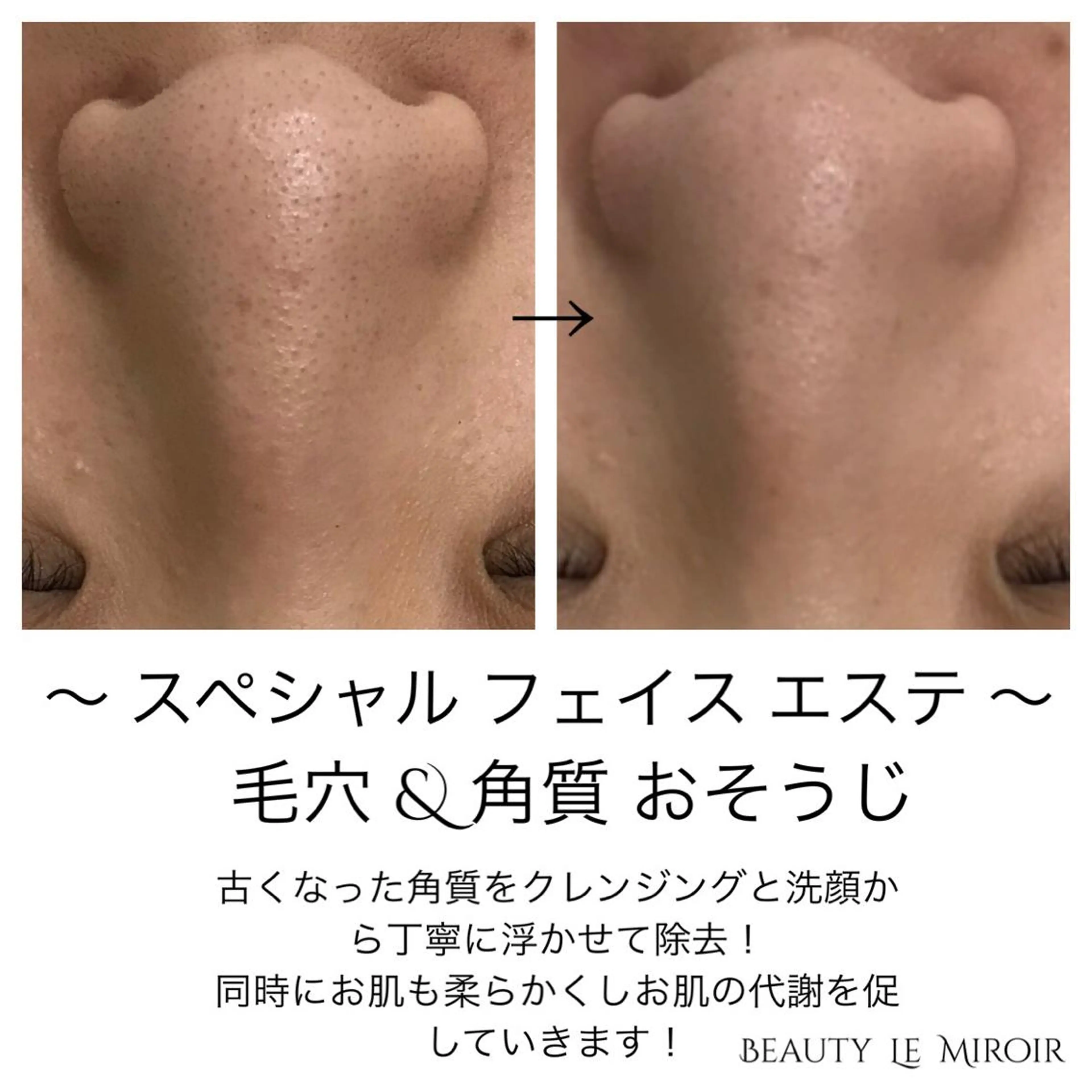 マツエク・マツパ ビューティー ミロワールのエステ・リラクイメージ