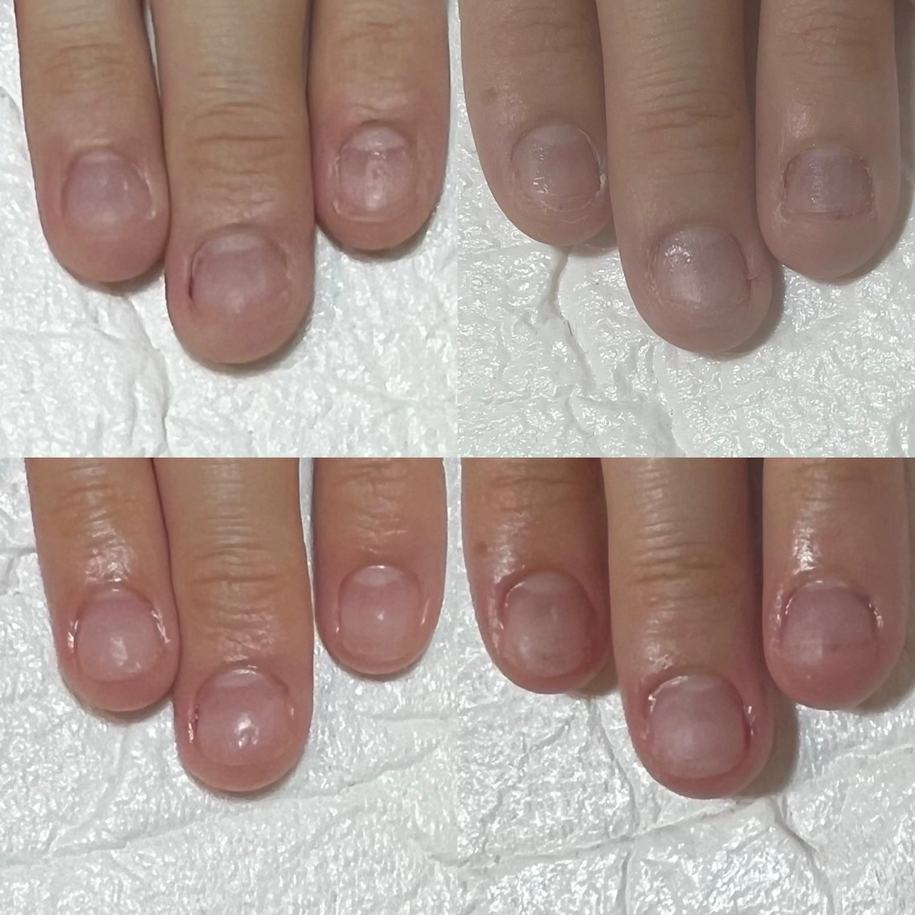 ネイル アートネイル クリアネイル ジェルネイル パラジェル 自爪育成・巻き爪 補正講師　津蔵のネイルデザイン