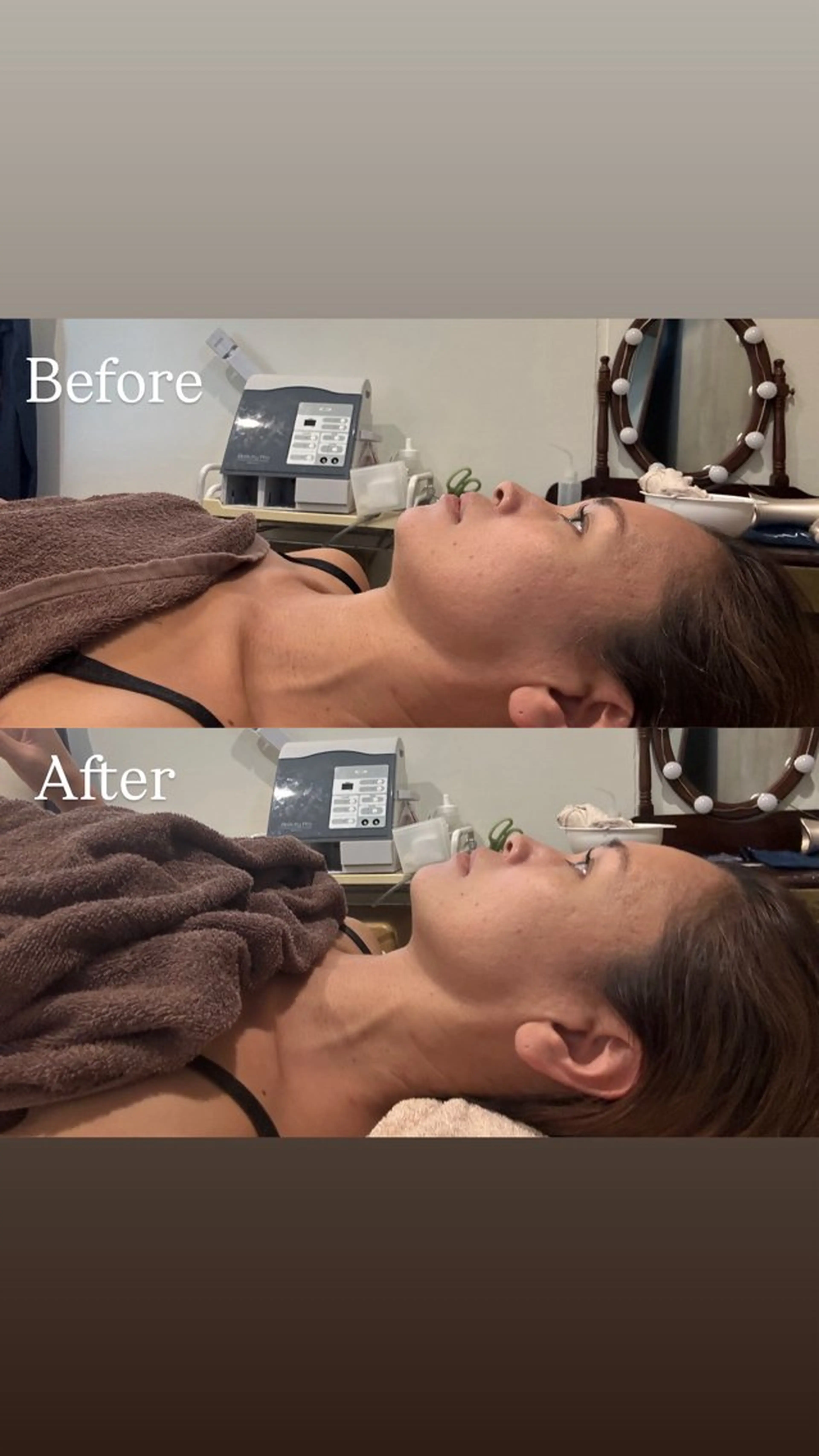 つるんとむき卵肌に 🌟ハーブピーリングのエステ・リラクイメージ