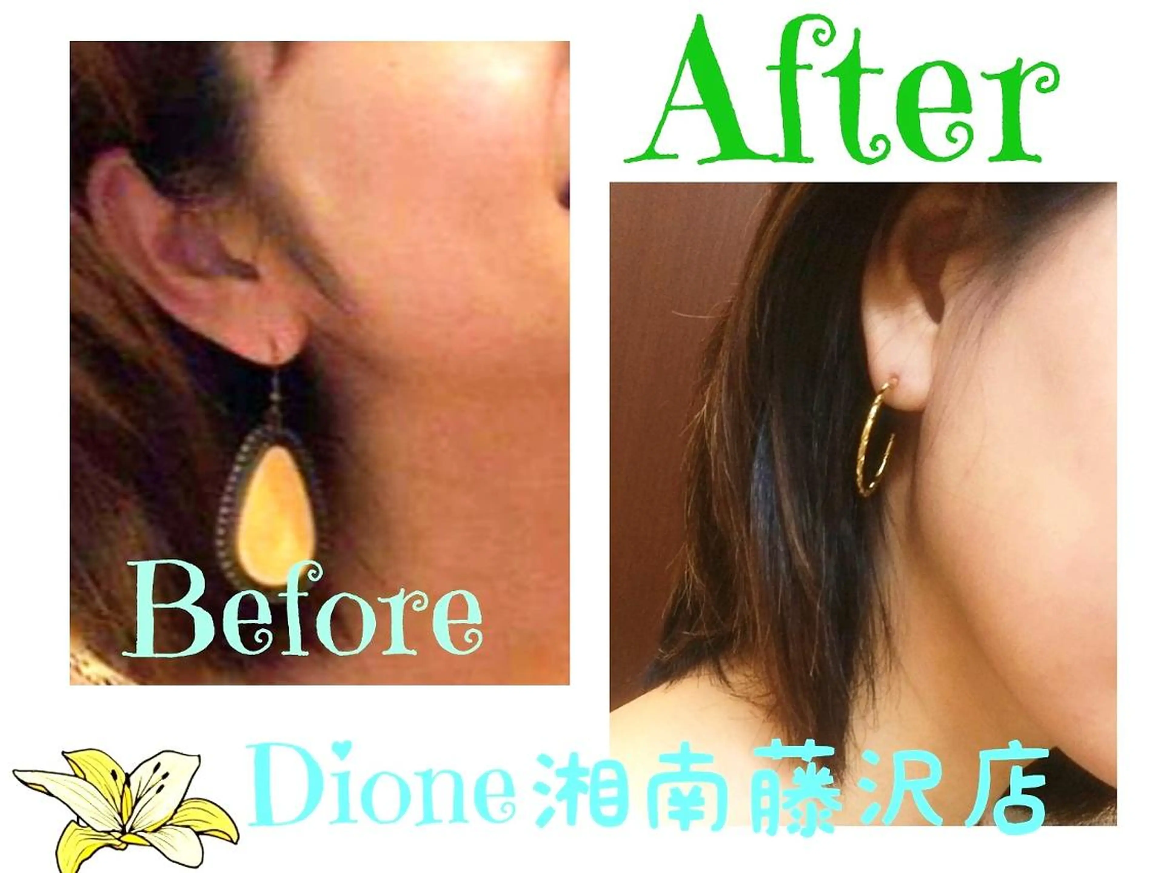 キッズ LUANA 美肌脱毛+Skinのエステ・リラクイメージ