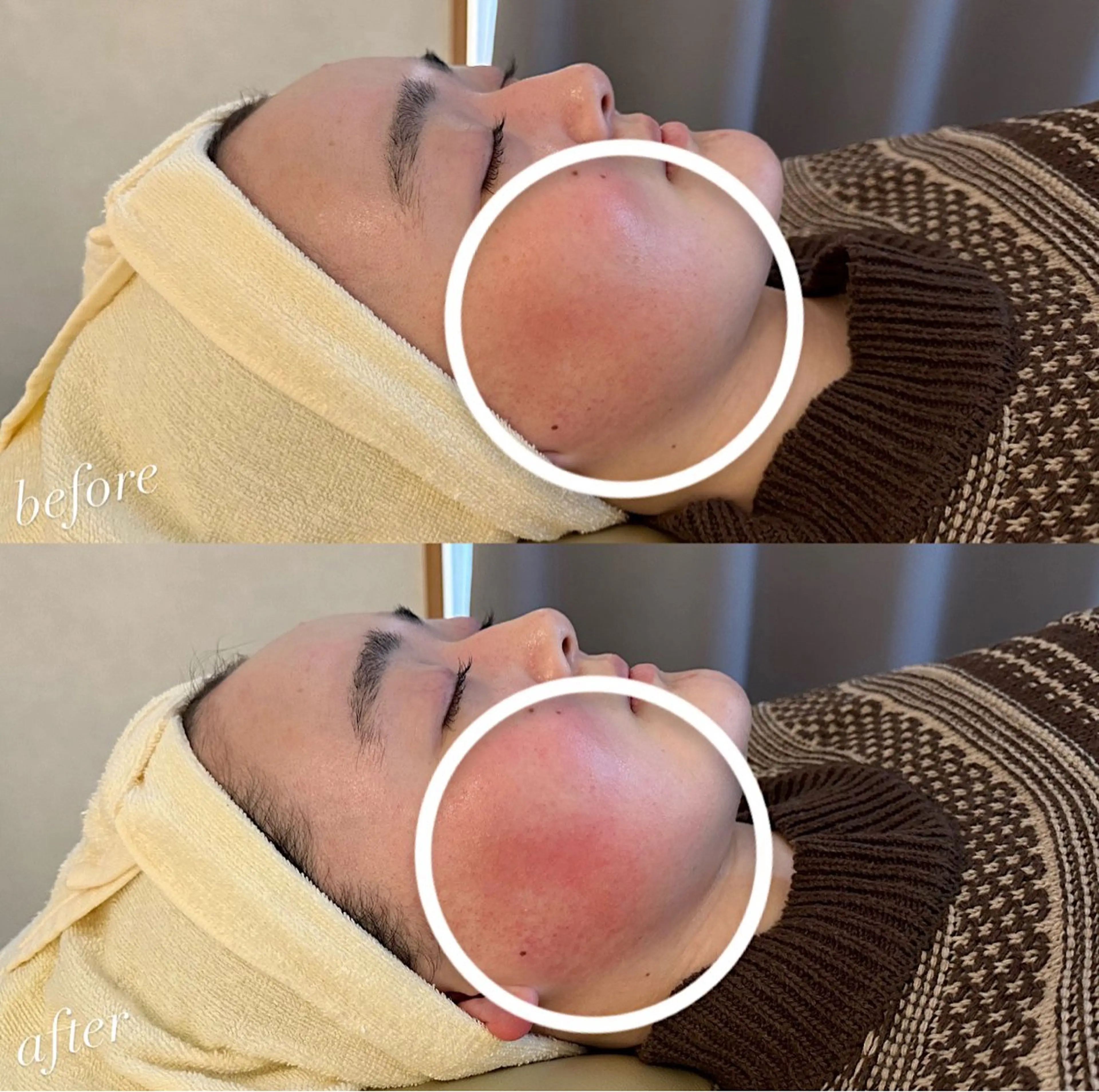 エステ うなじ脱毛/美肌脱毛 LABELのエステ・リラクイメージ