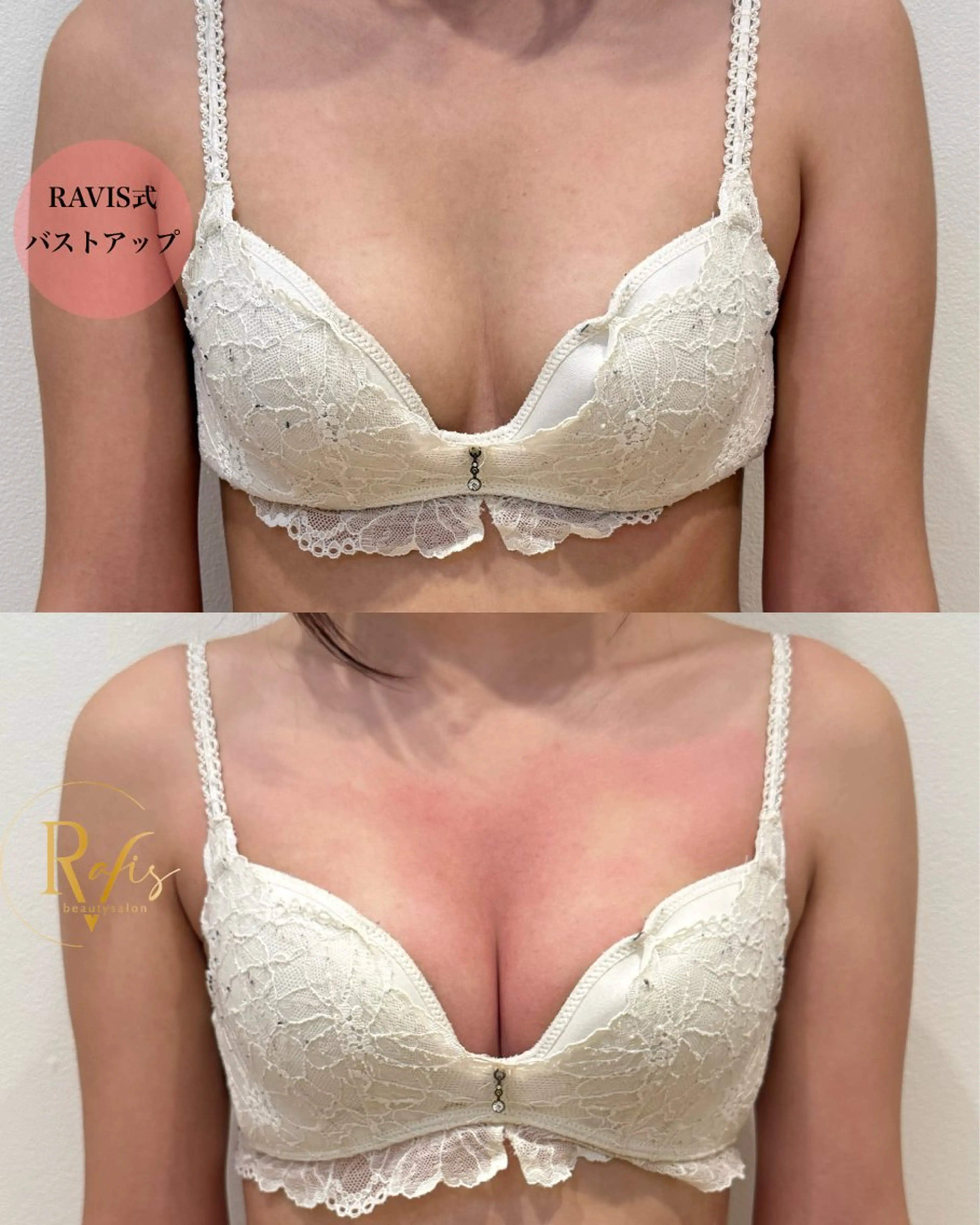 エステ beautysalon RAVIS所属・東大阪/韓国肌管理/ 痩身バスト専門店のエステ・リラクイメージ