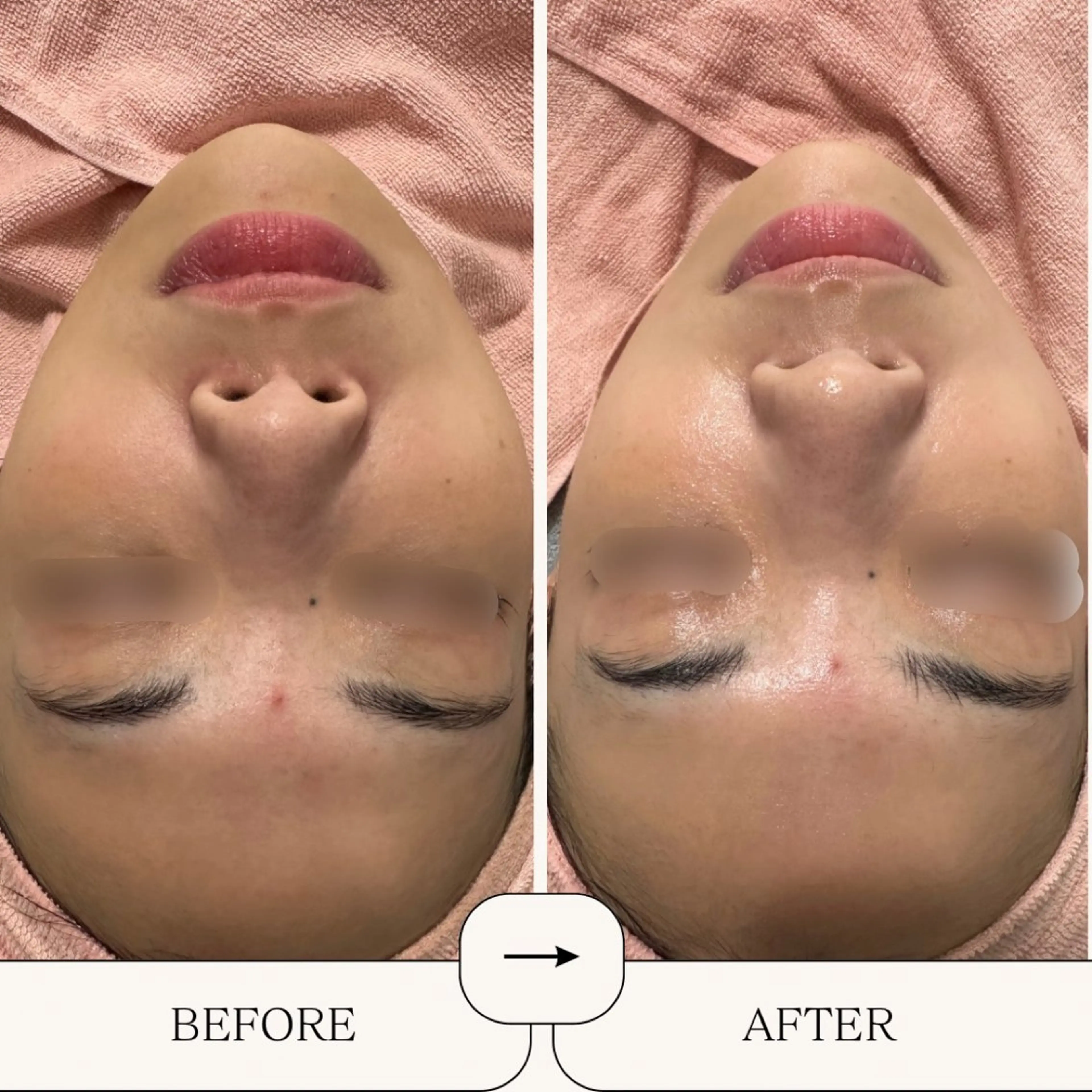 エステ BestBelleꕤ 大阪福島/肌質改善のエステ・リラクイメージ