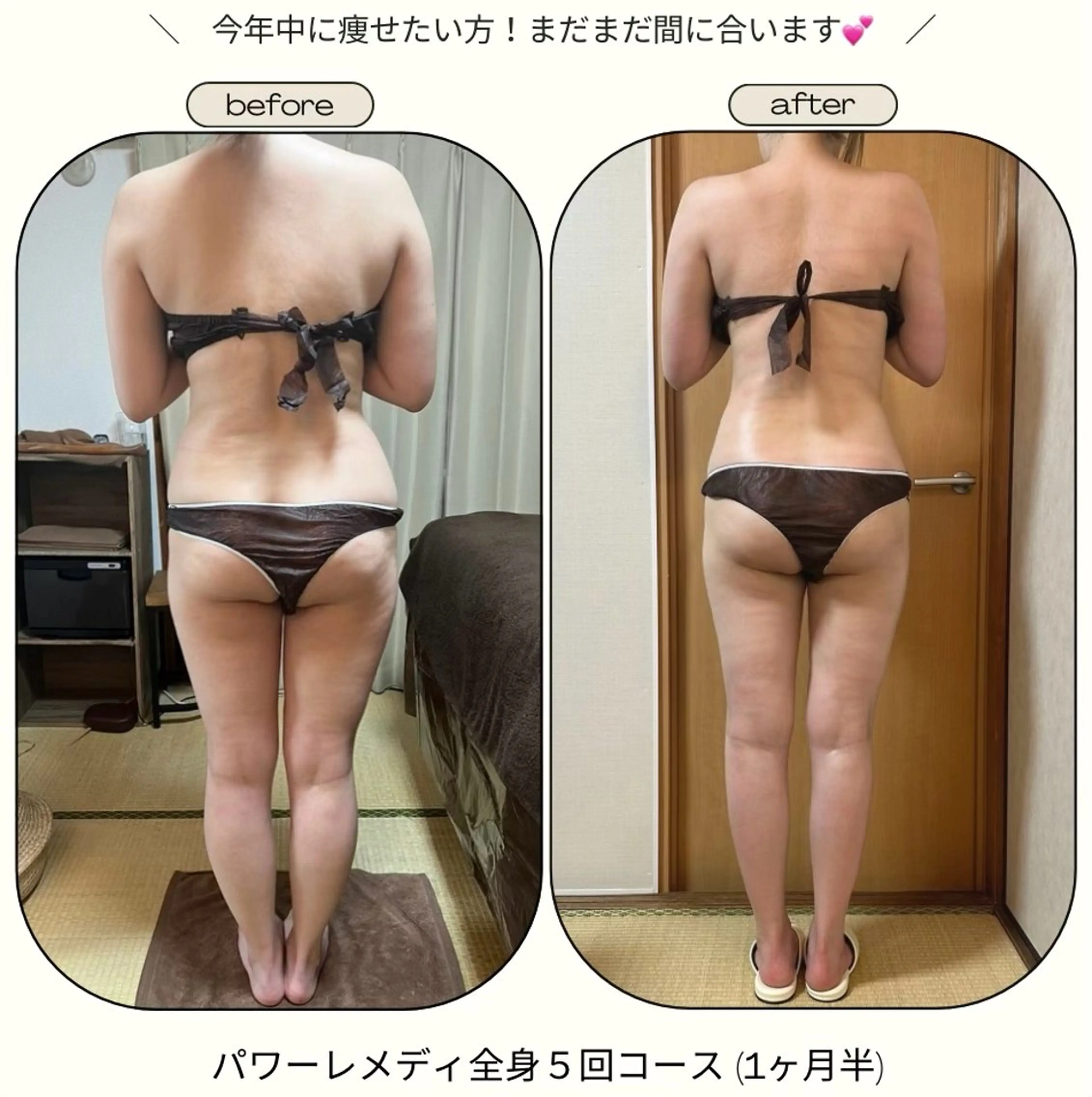 《本気痩せ×疲労改善 》  BILOOPのエステ・リラクイメージ