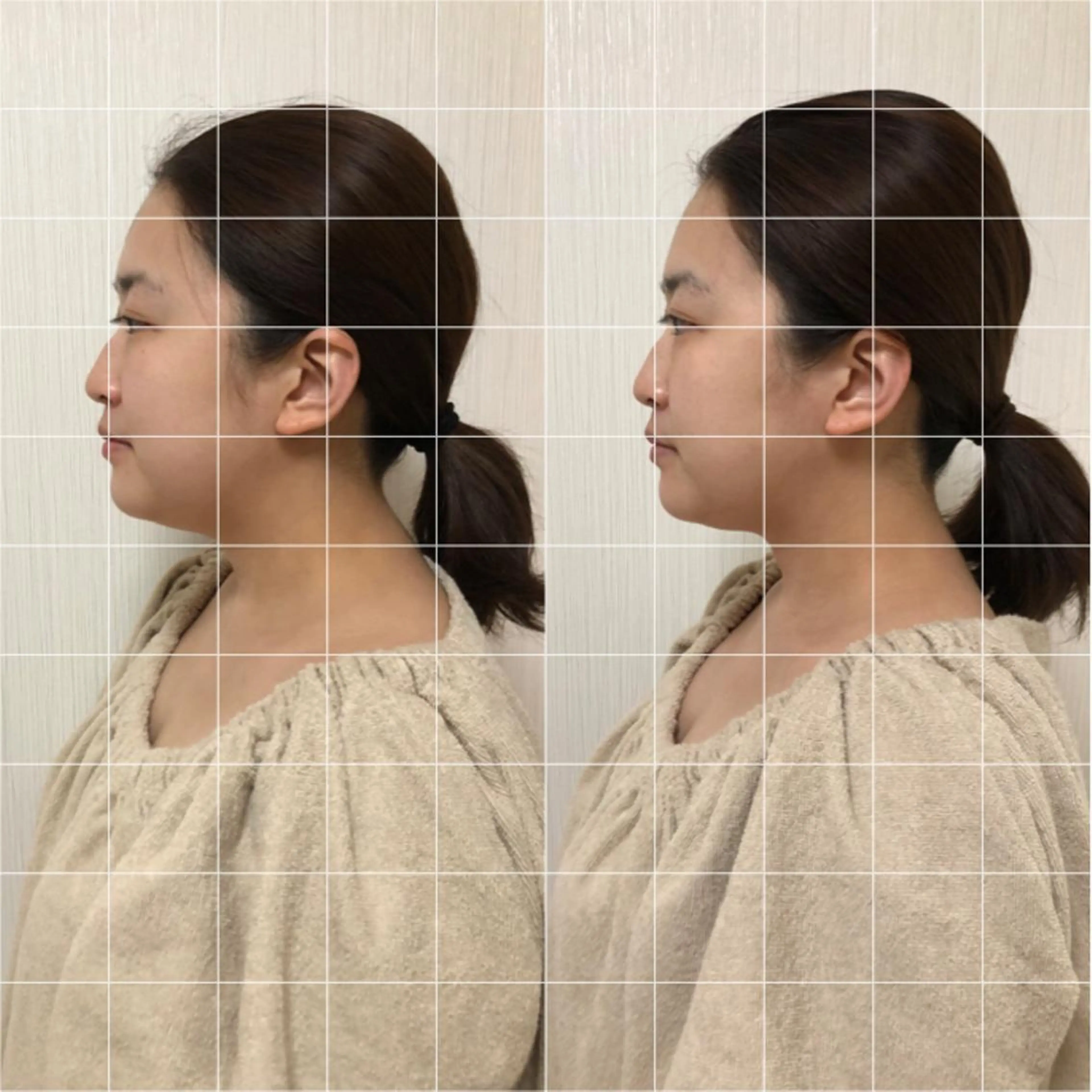 ショート カラー ヘアアレンジ ネイル マツエク・マツパ 即小顔•眠りの 温ヘッド【jiu】のエステ・リラクイメージ