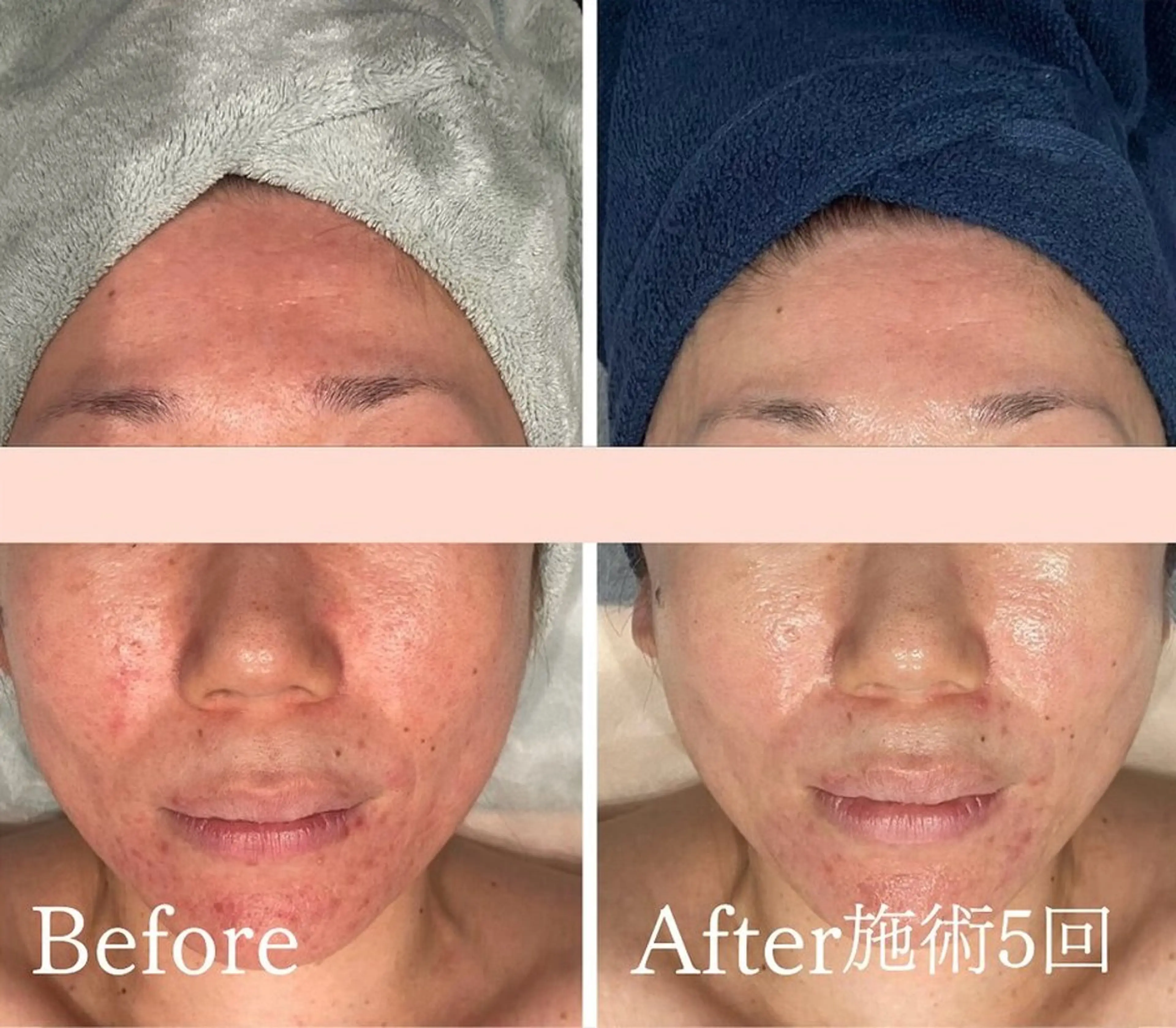 アンド ミルルのエステ・リラクイメージ