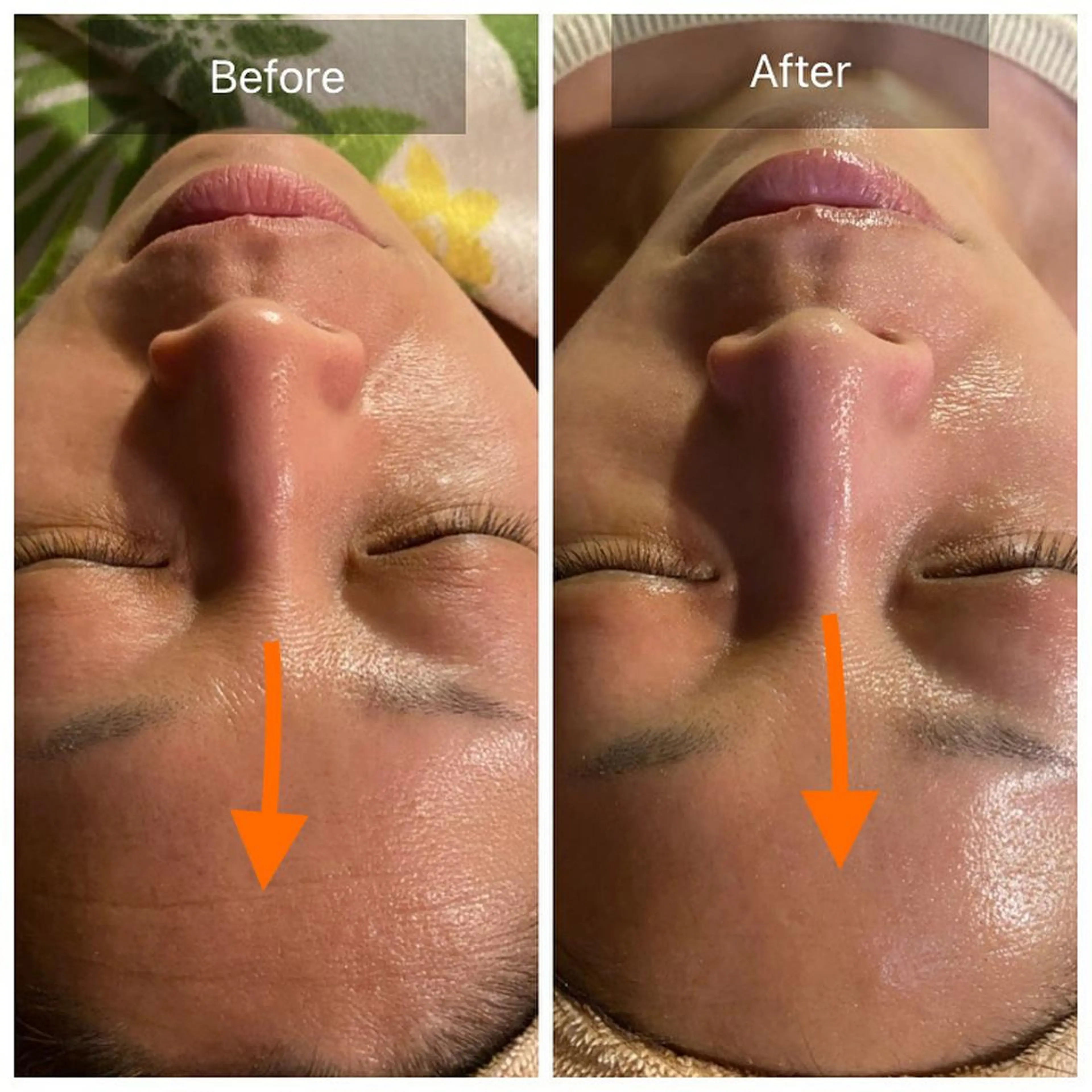 エステ Mandarin Orange所属・毛穴から始める肌メン テマンダリンオレンジのエステ・リラクイメージ