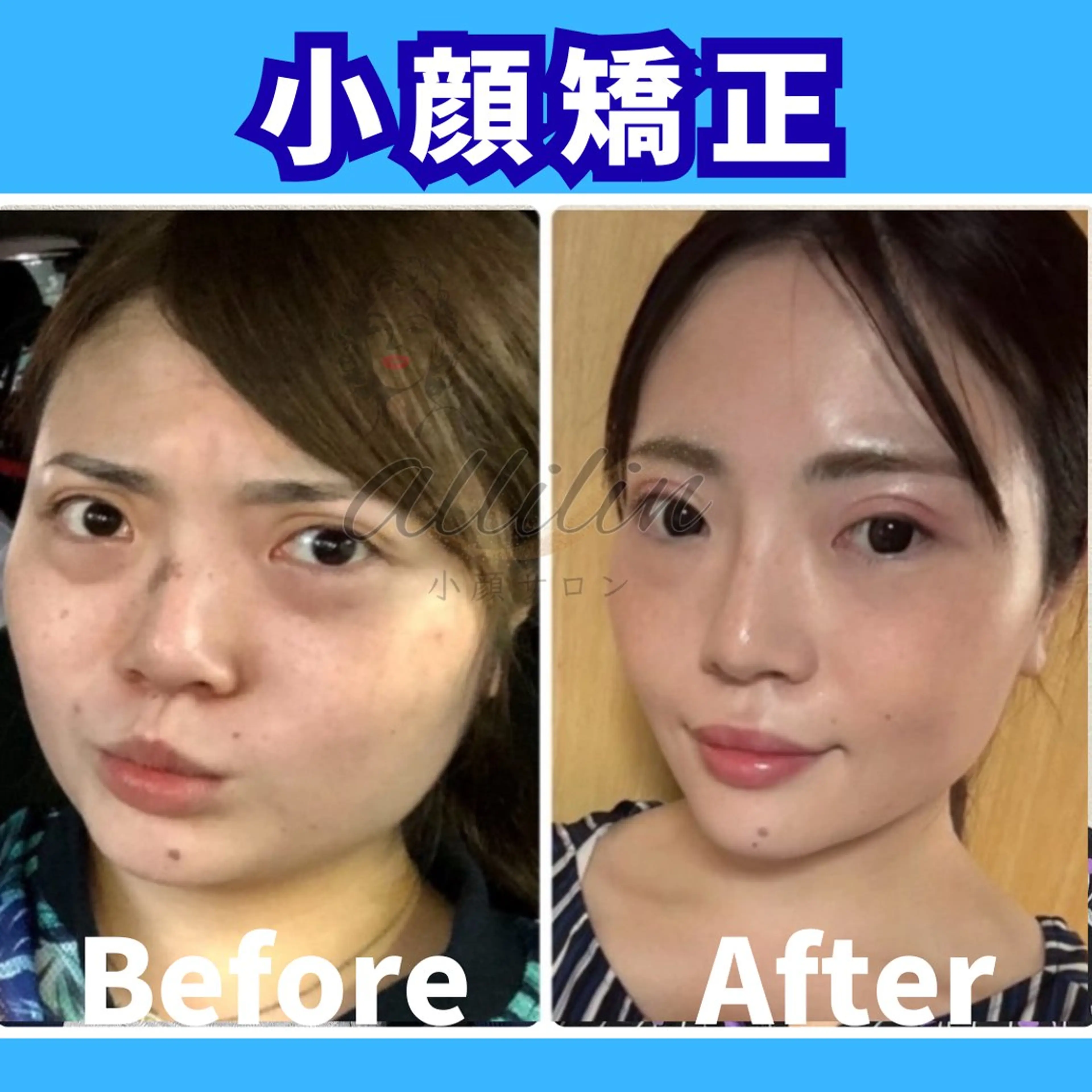 エステ 💎小顔ｻﾛﾝ アリリン銀座💎のエステ・リラクイメージ