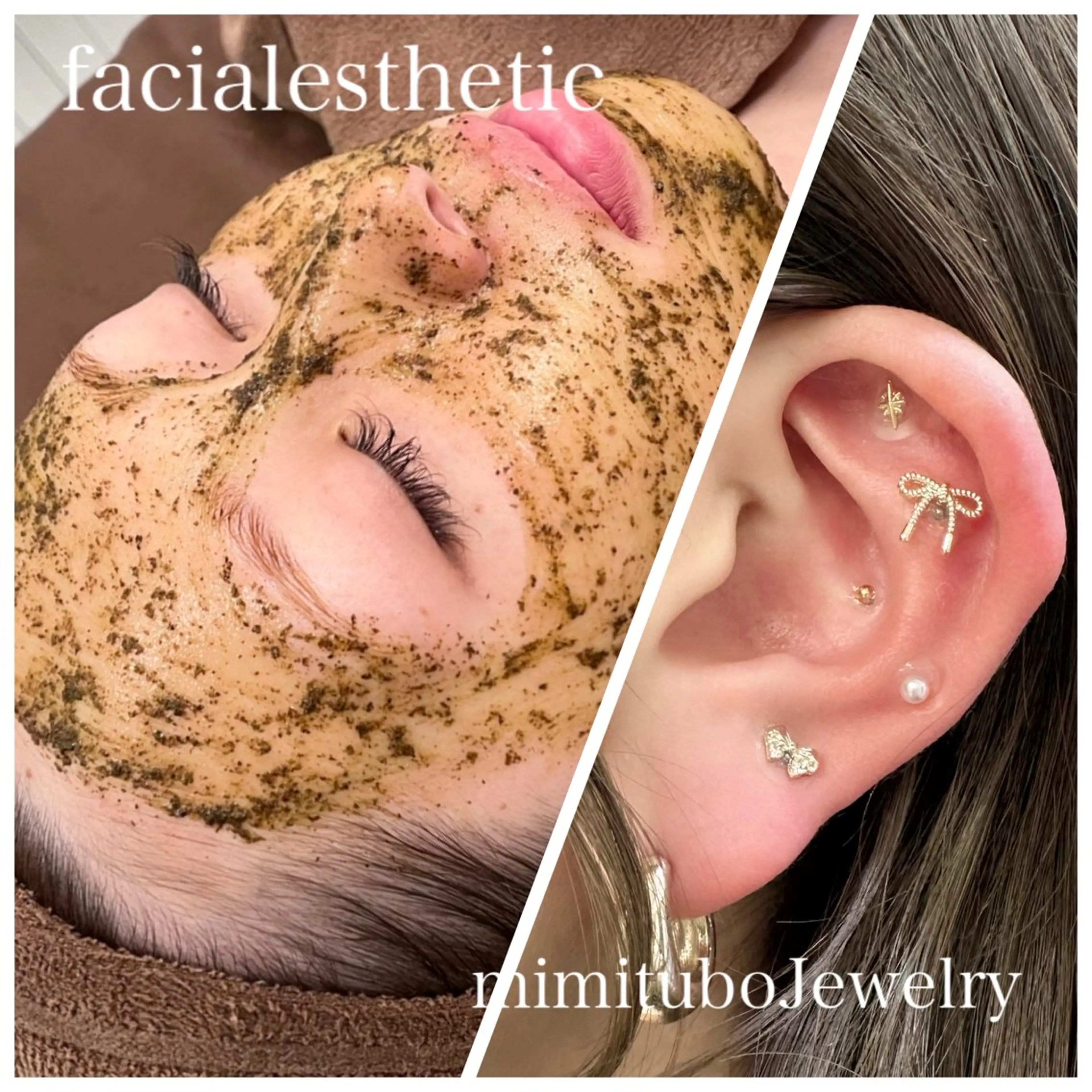 🩵話題の施術がセットでお得🩵選べる肌質別ピーリング🫧➕耳つぼジュエリー10個💎✨の写真