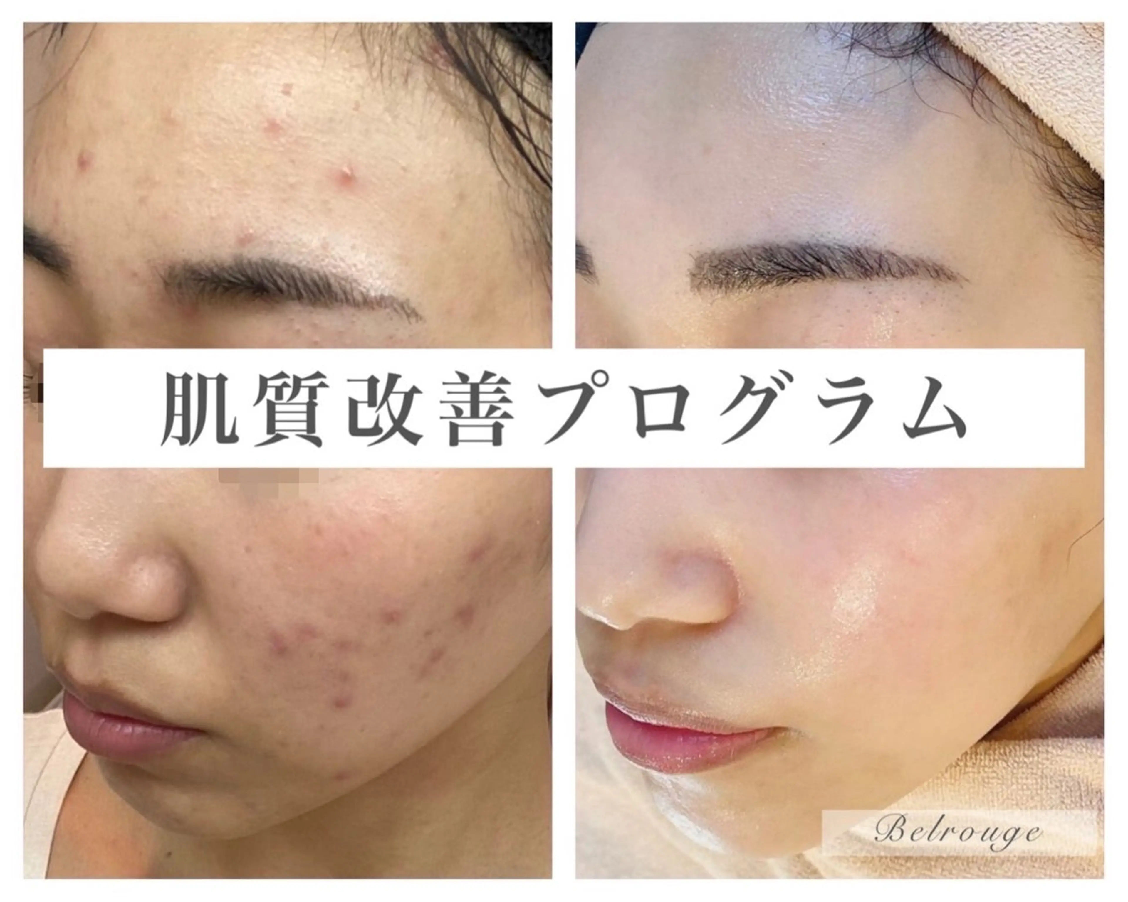 エステ 自由が丘📍 Belrougeのエステ・リラクイメージ