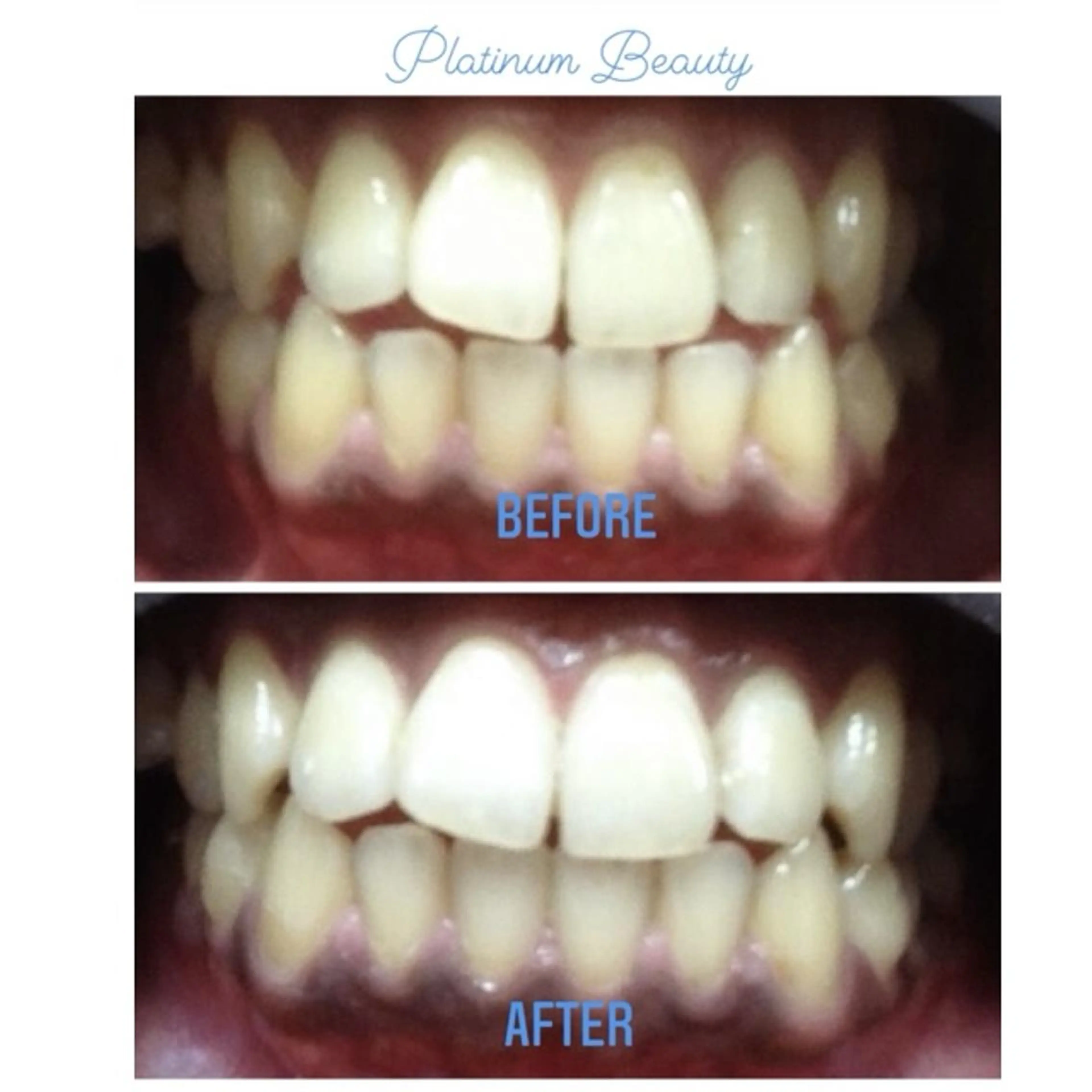 その他 プラティーヌ ボーテのその他イメージ