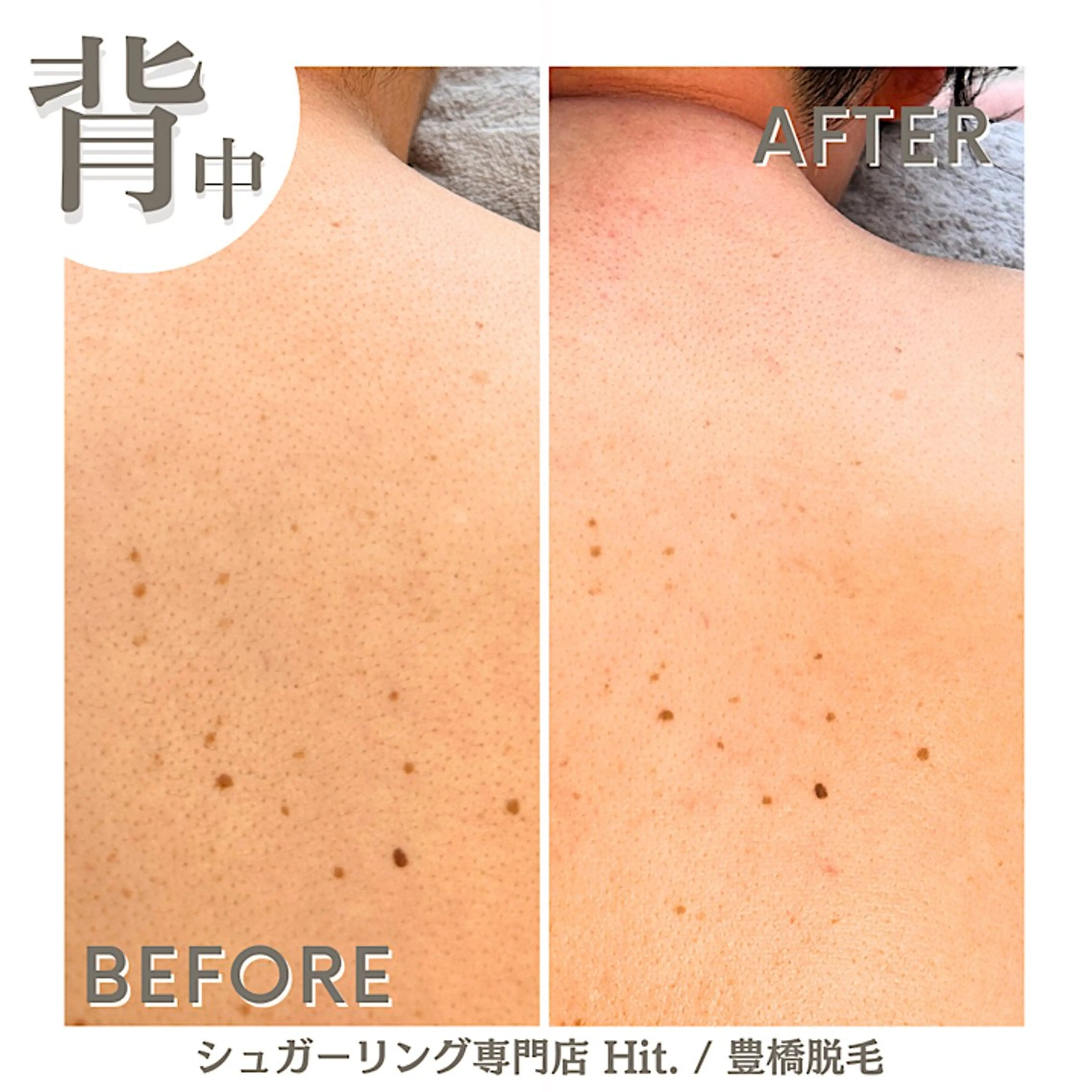 Hitomi シュガーリング豊橋のその他イメージ