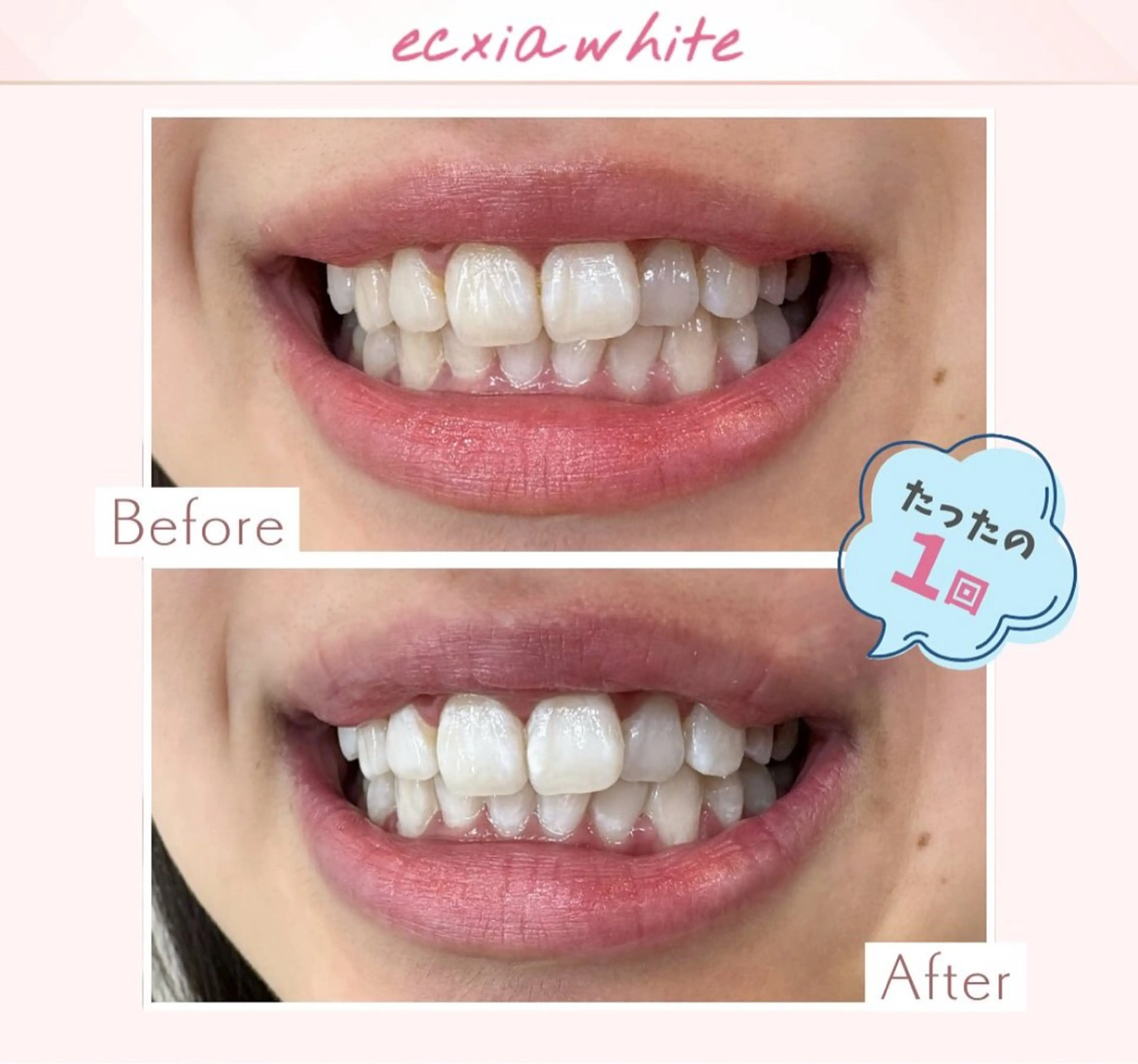 その他 セルフホワイトニングエクシア小山店所属・セルフホワイトニング エクシア小山店のその他イメージ