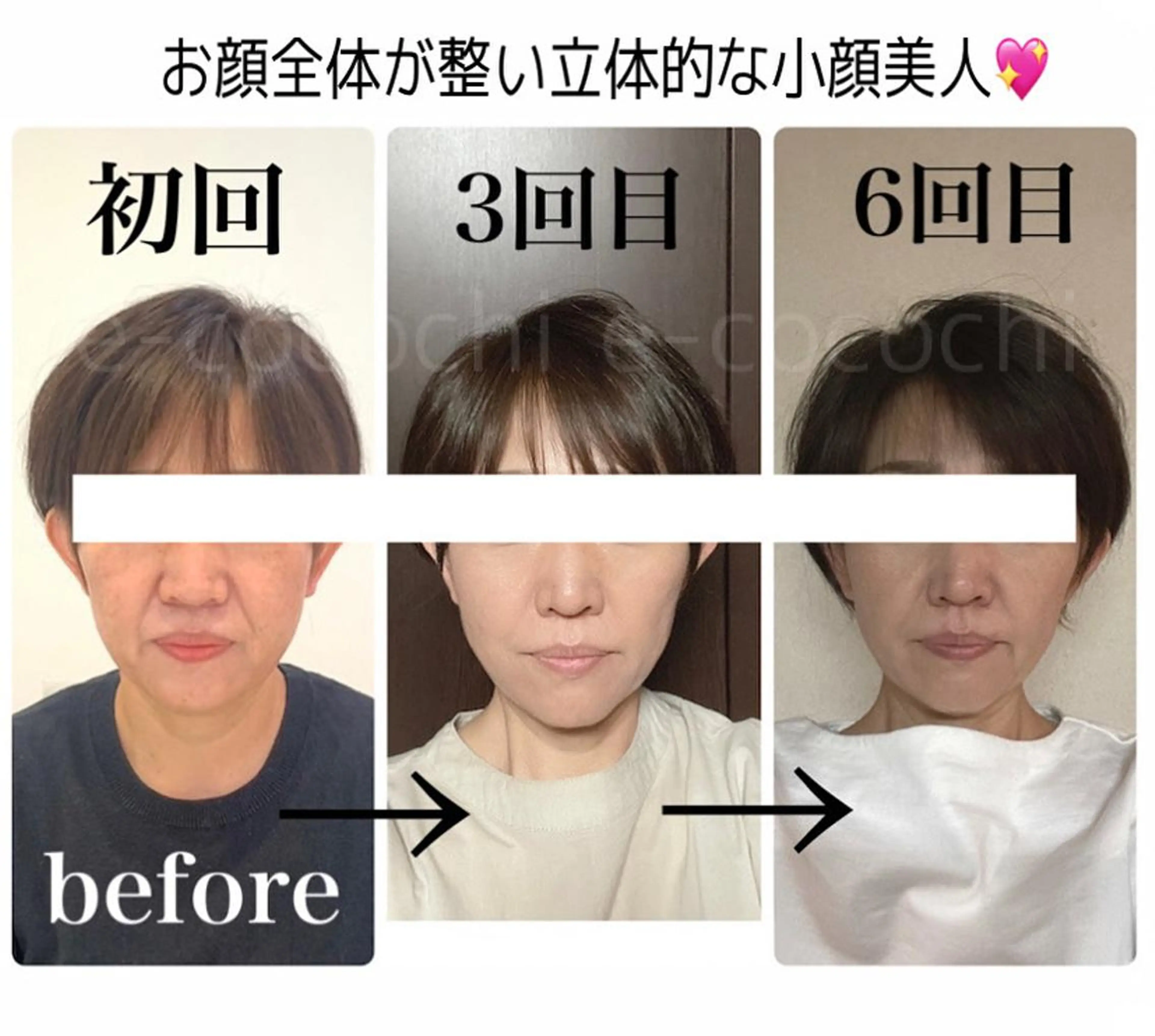 エステ 小顔と ヘッドスパのお店のエステ・リラクイメージ