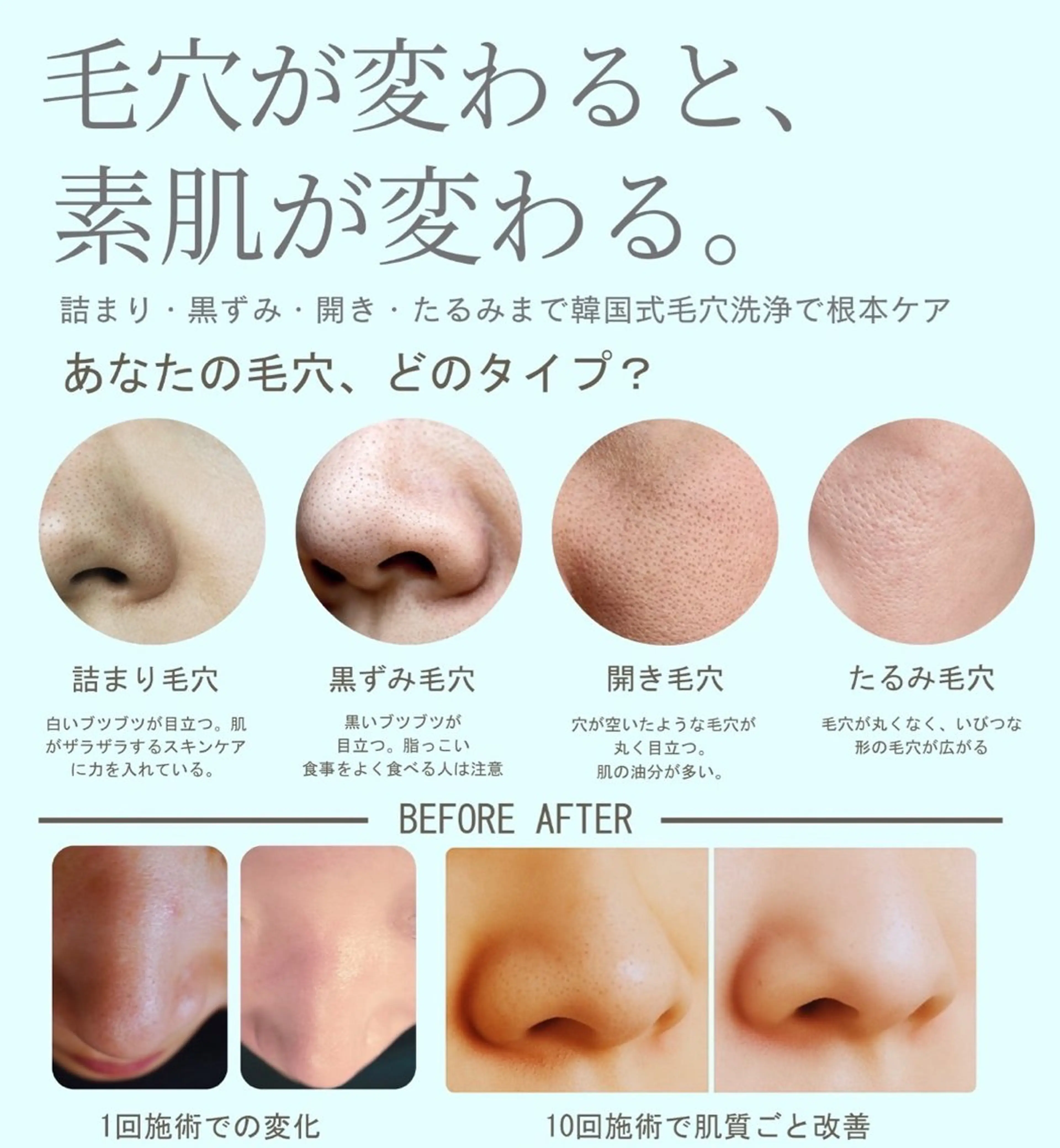 韓国式🇰🇷毛穴洗浄✨✨鏡を見る度に気になる毛穴、、、毛穴洗浄で綺麗サッパリ毛穴のお悩みとおさらばしてみませんか？の写真