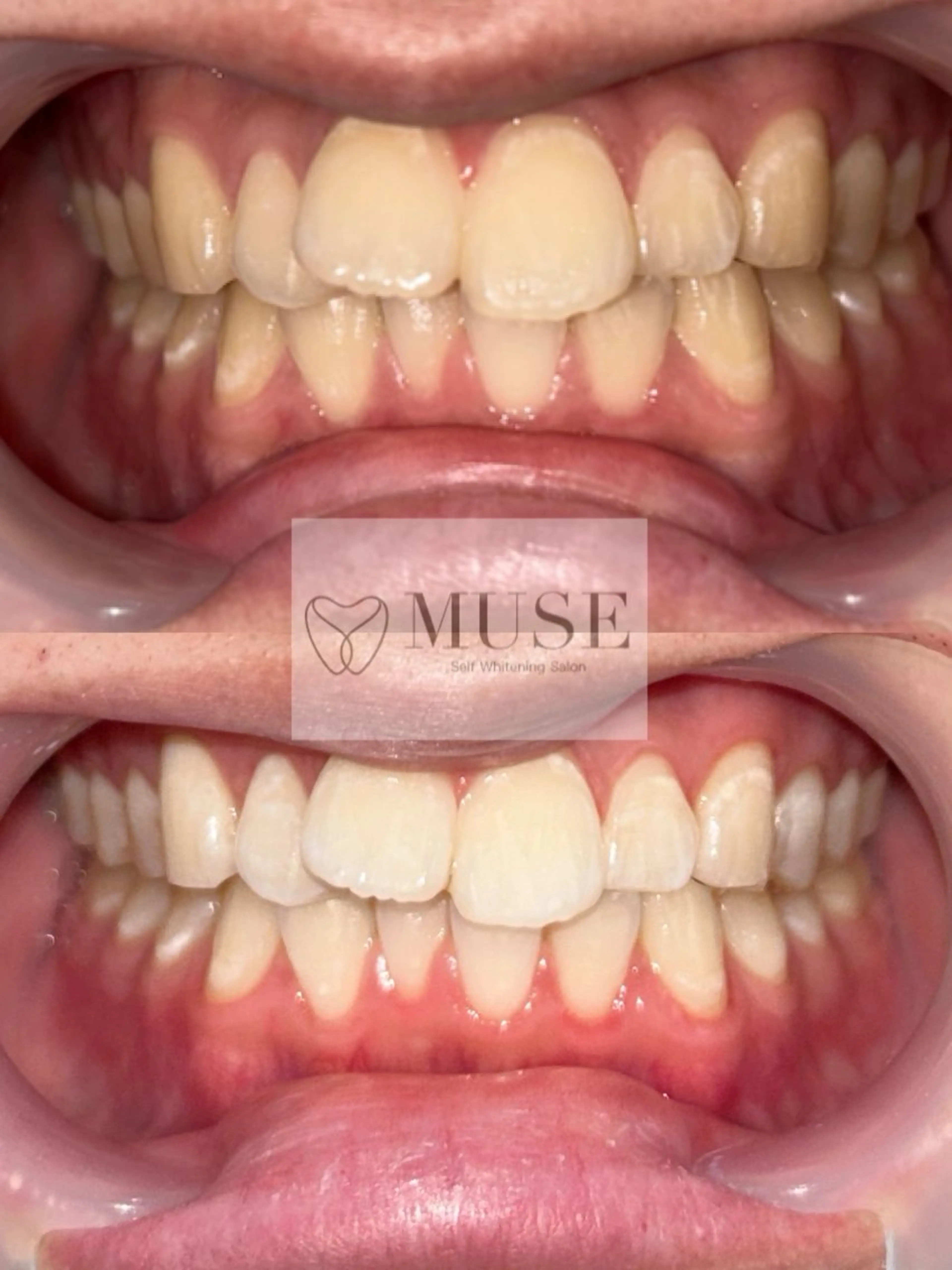 その他 セルフホワイトニングサロンMUSE所属・セルフホワイトニング MUSE🫧焼津のその他イメージ
