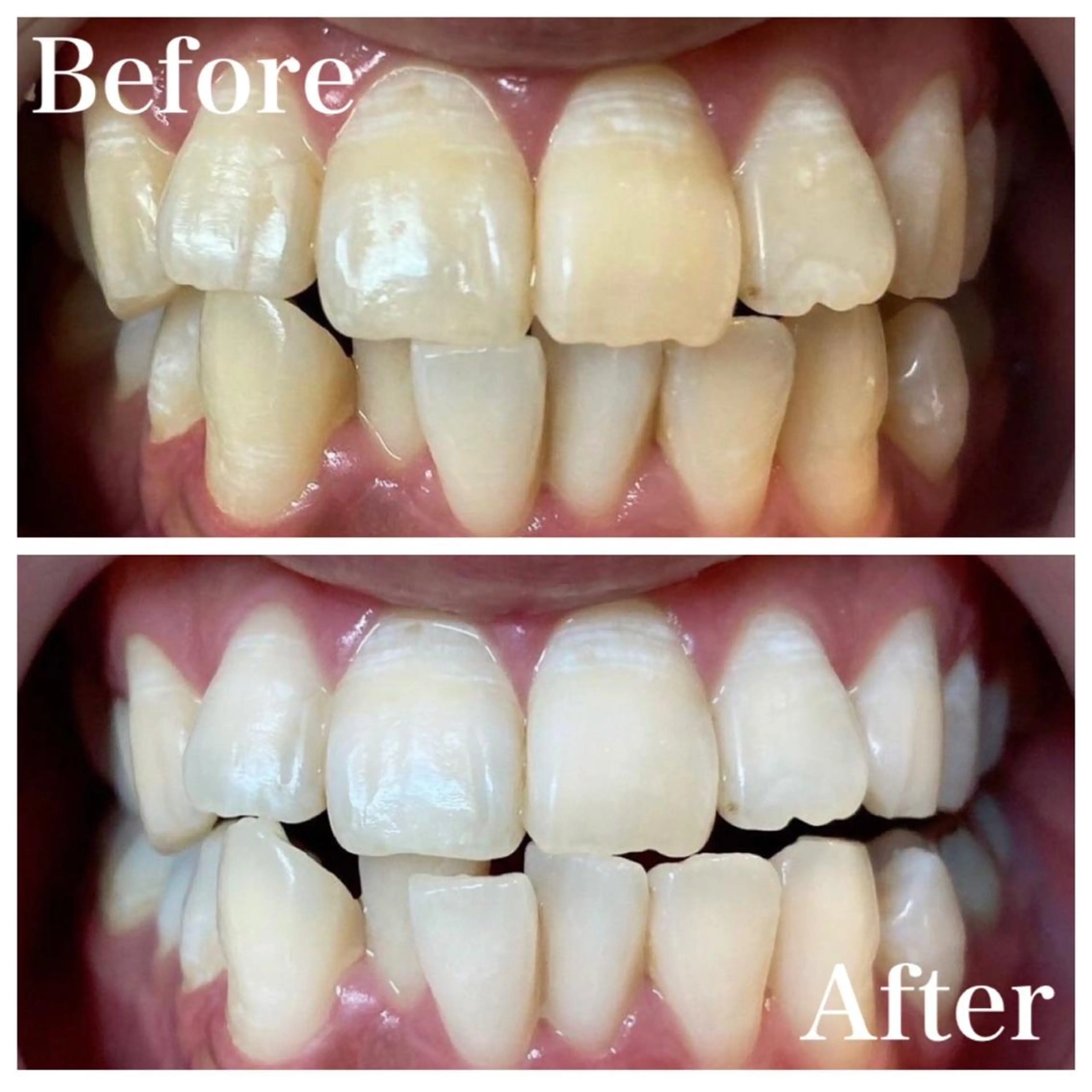 LBSホワイトニング 🌸梅田店公式のその他イメージ