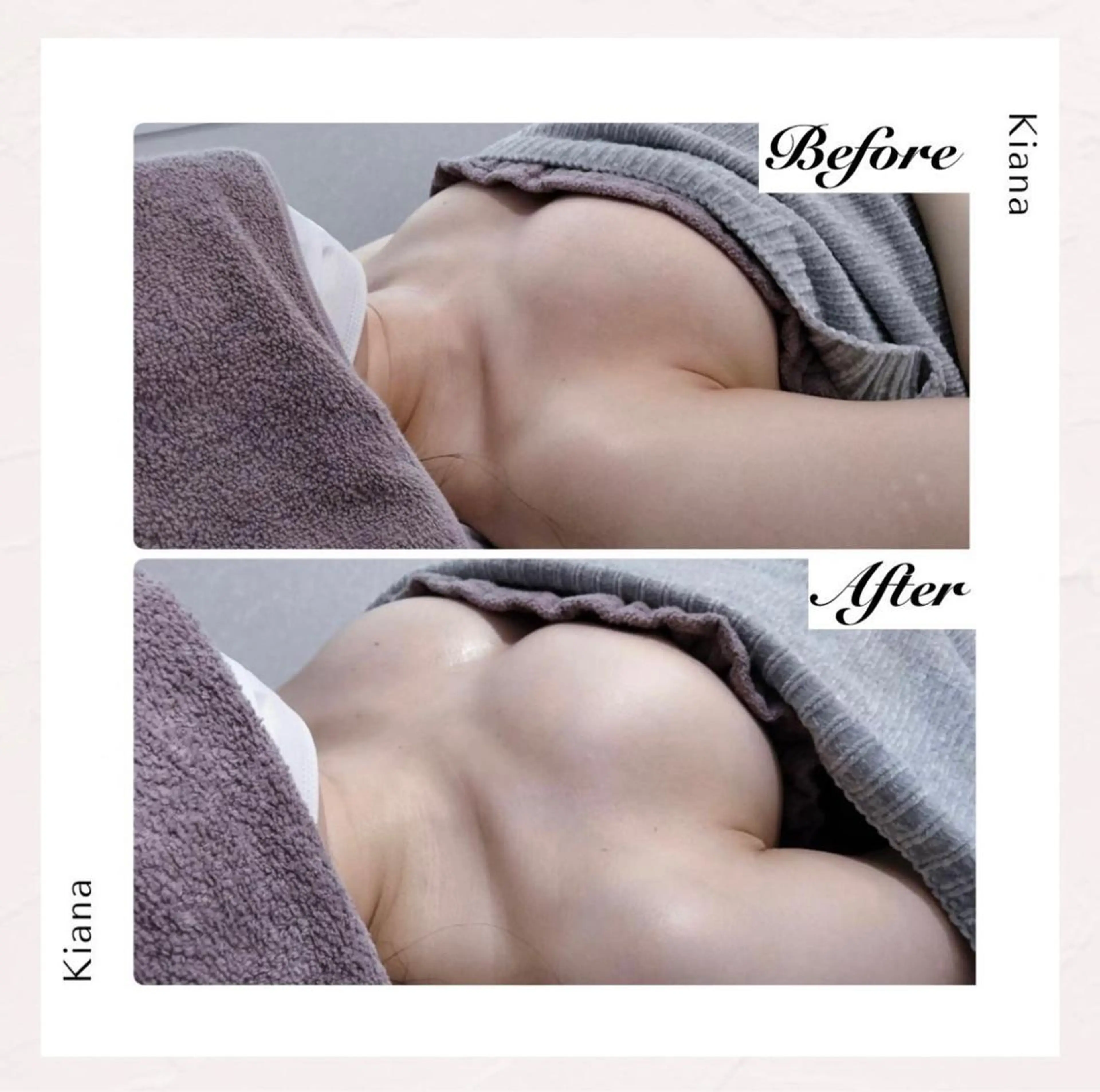 バスト専門Kiana 風のエステ・リラクイメージ